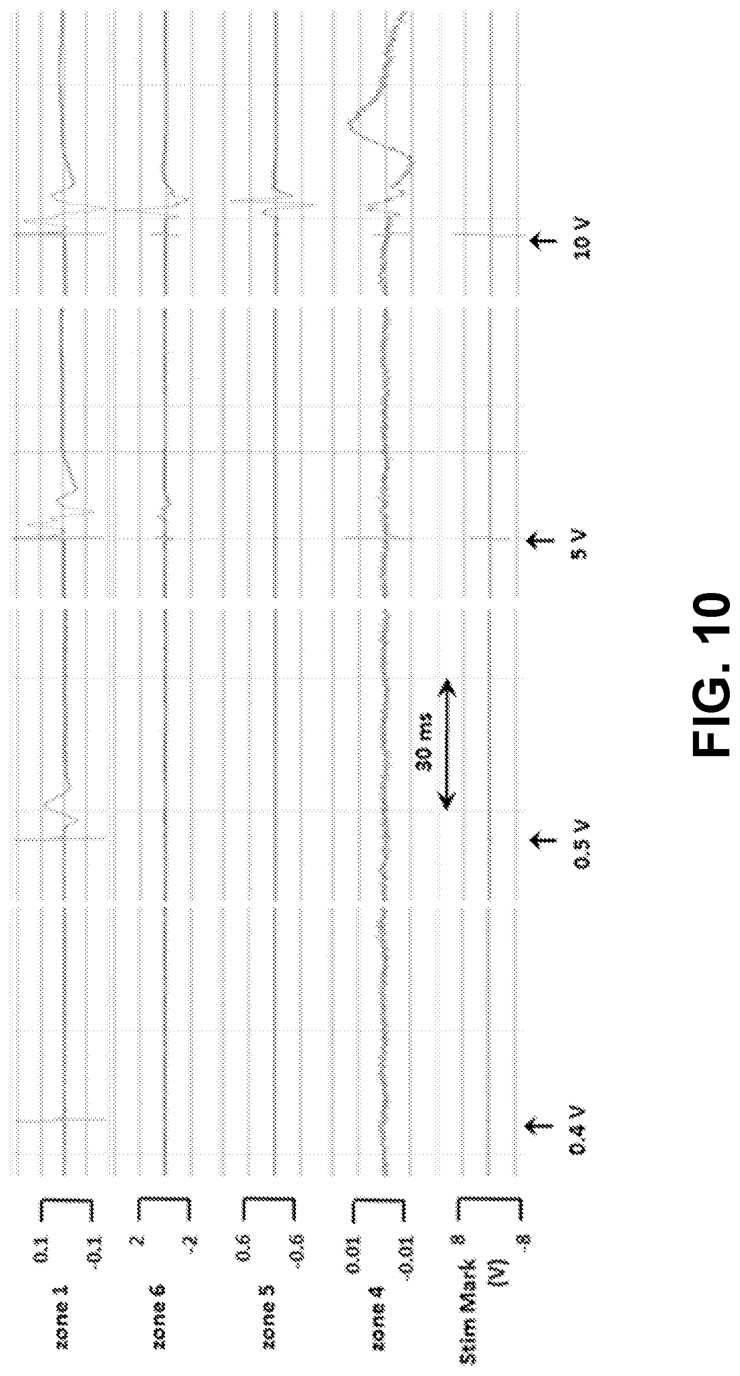 Patent US12090321 Figure 9 – Lead placement for nerve stimulation