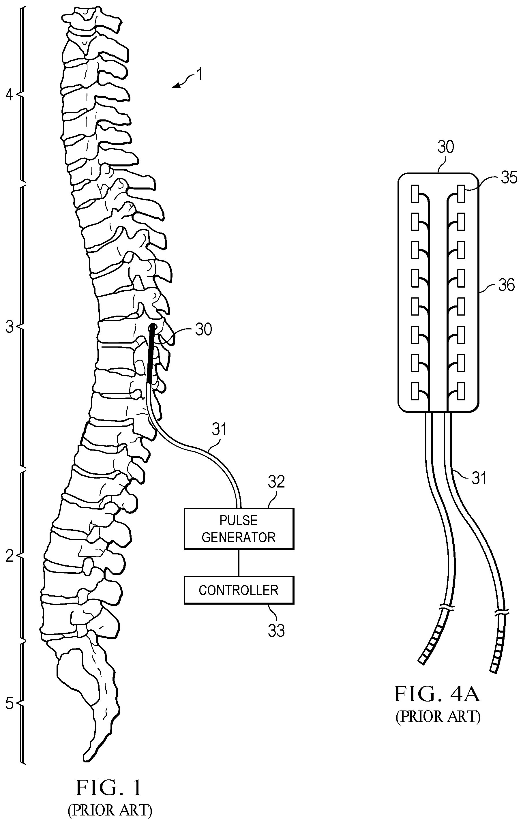 Patent US12090322 Figure 1 – Randomized intermittent stimulation paradigm and method of use