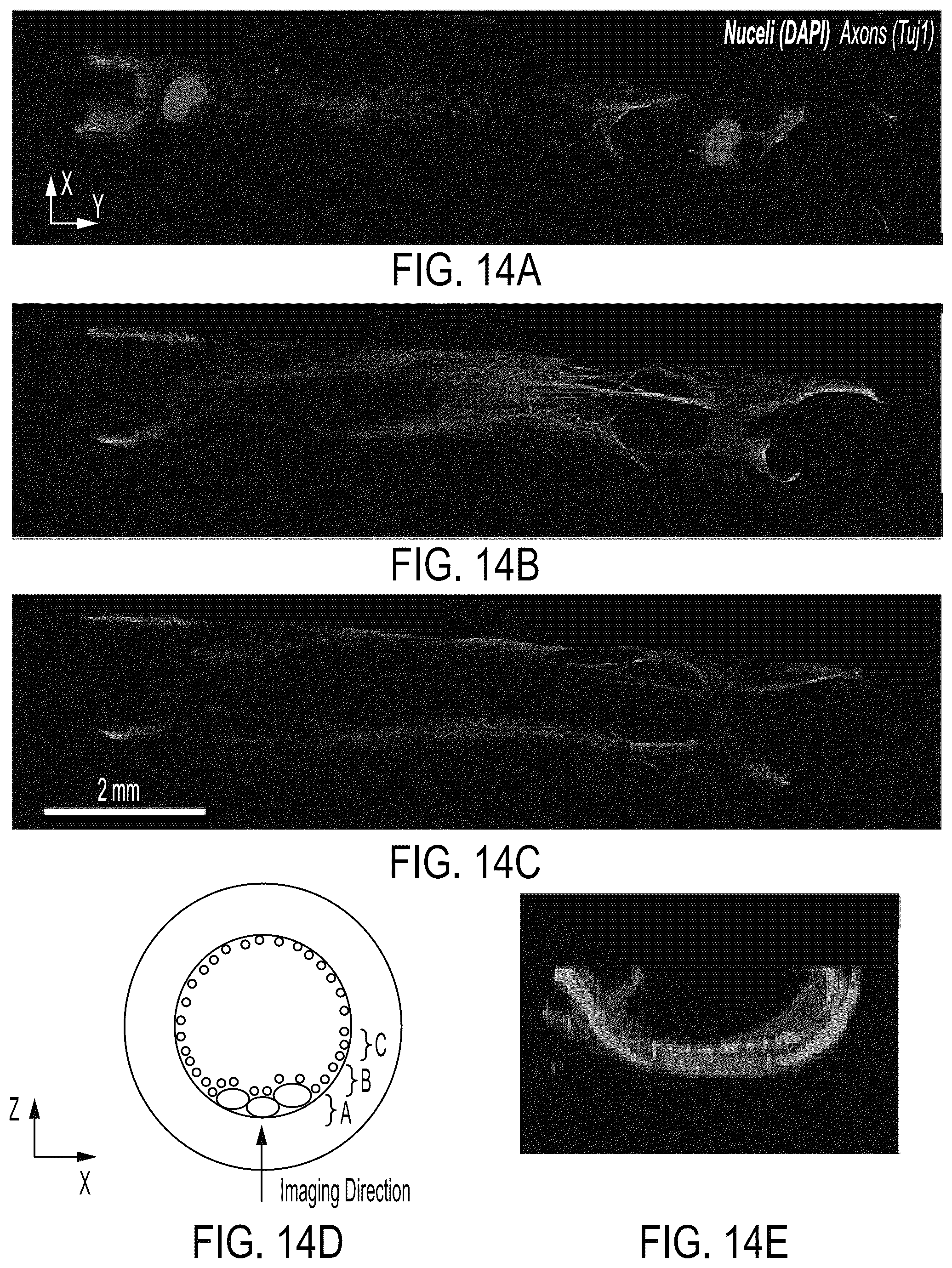 Patent US12090323 Figure 14 – Implantable living electrodes and methods for use thereof