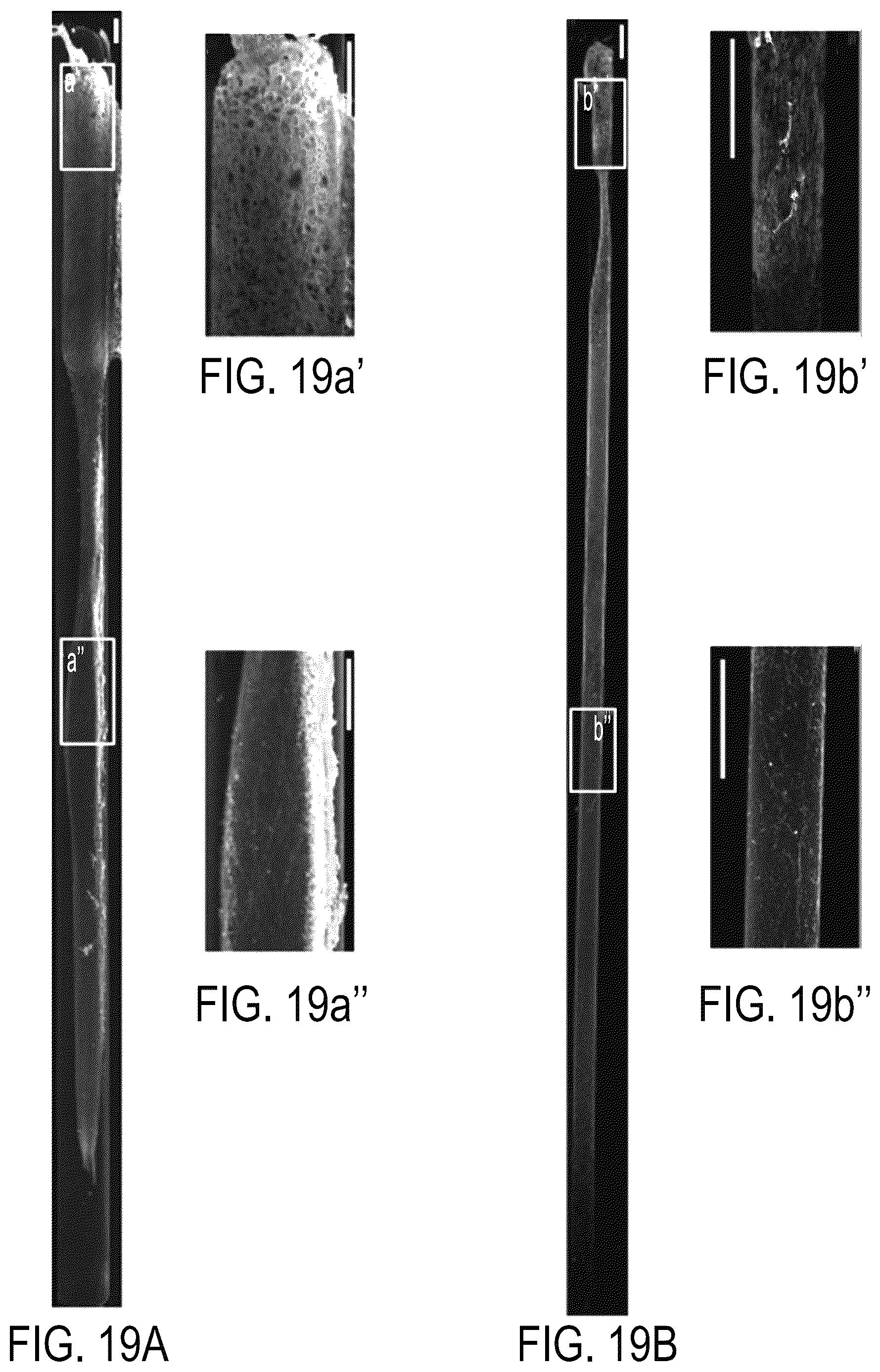 Patent US12090323 Figure 19 – Implantable living electrodes and methods for use thereof