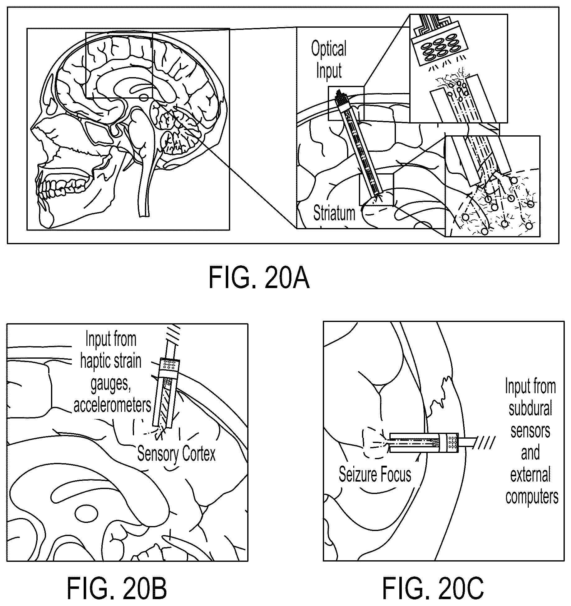 Patent US12090323 Figure 20 – Implantable living electrodes and methods for use thereof