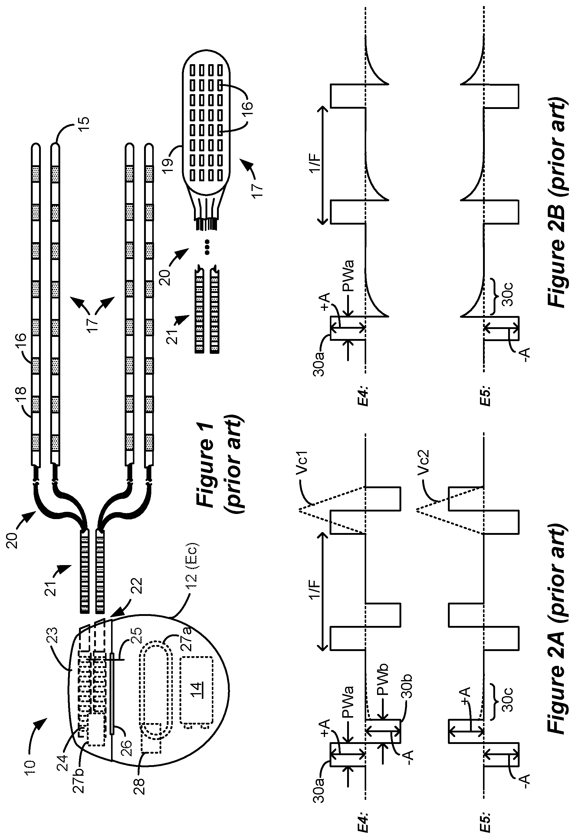 Patent US12090324 Figure 1 – Spinal cord stimulation for dorsal column recruitment or suppression using anodic and cathodic pulses