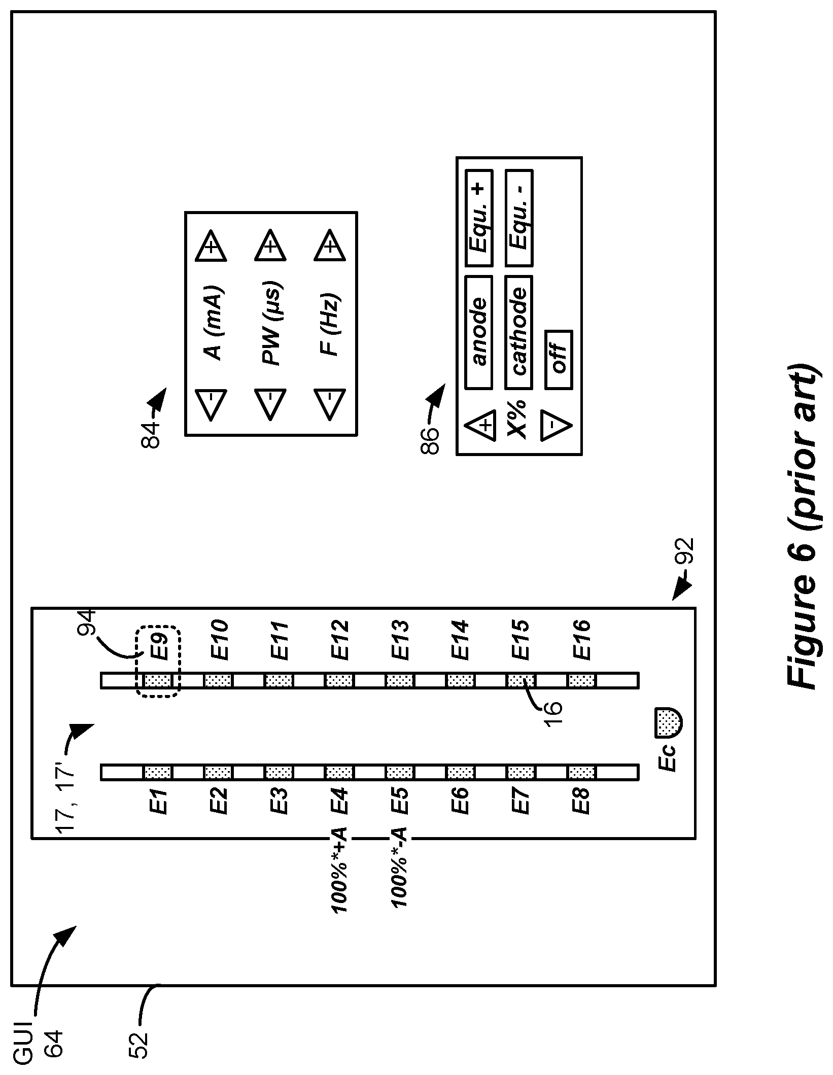 Patent US12090324 Figure 4 – Spinal cord stimulation for dorsal column recruitment or suppression using anodic and cathodic pulses