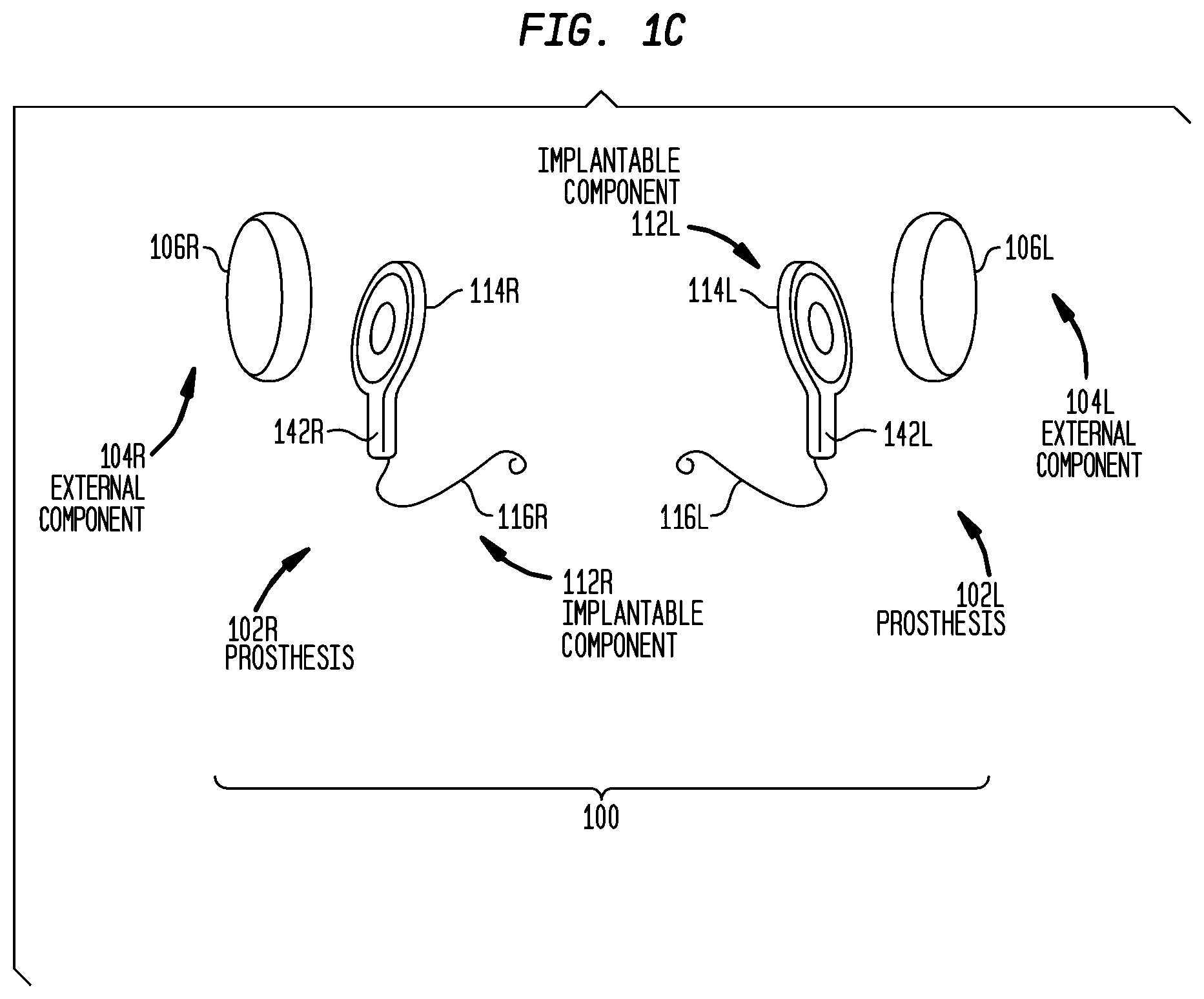 Patent US12090327 Figure 2 – Synchronized pitch and timing cues in a hearing prosthesis system