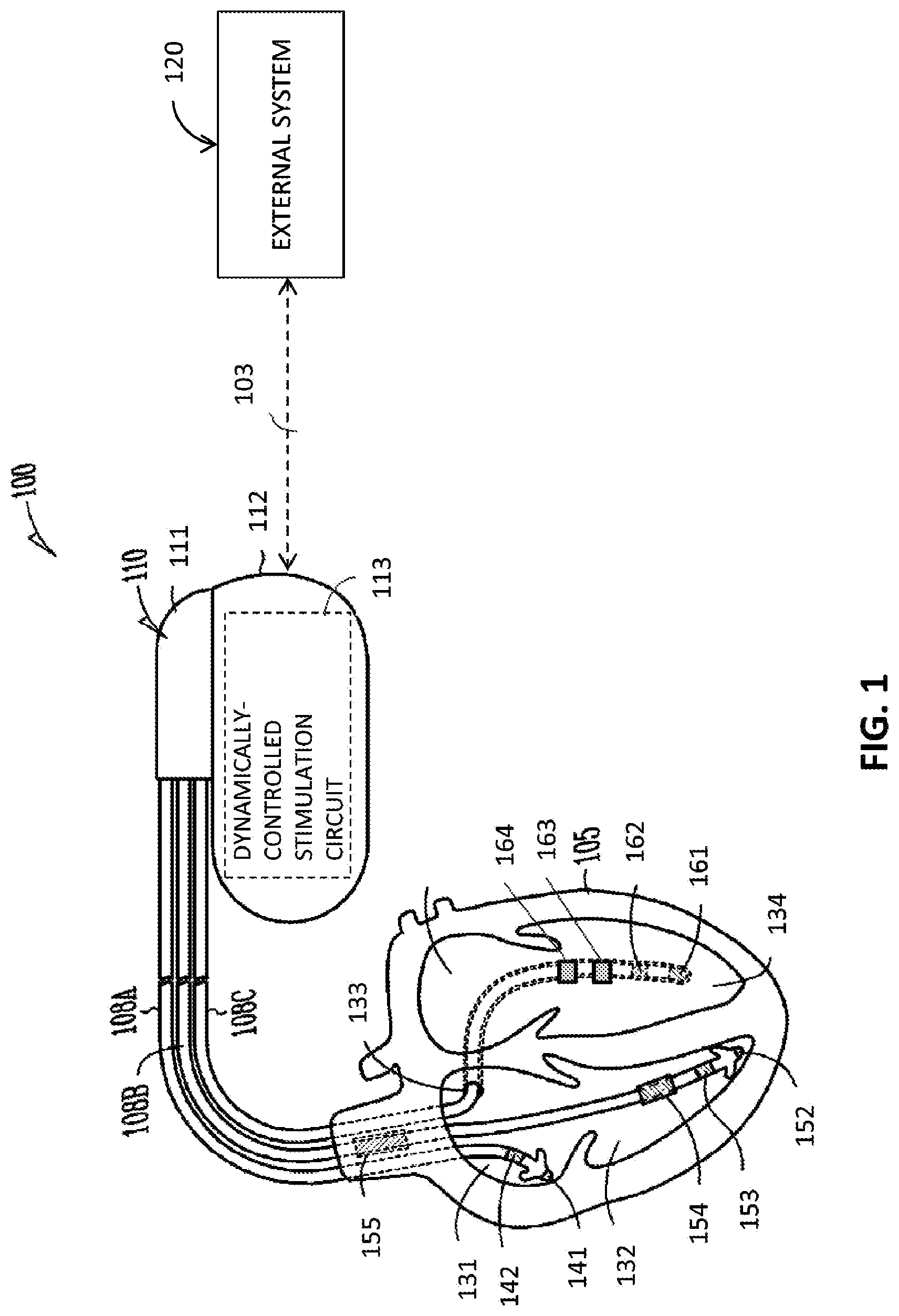 Patent US12090328 Figure 1 – Dynamic atrioventricular delay optimization
