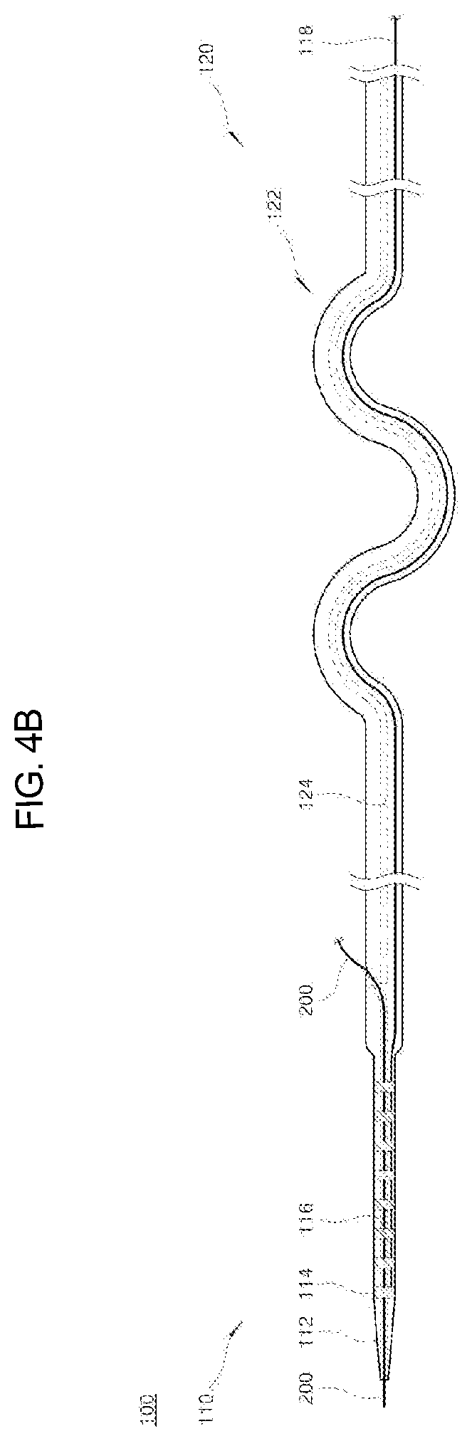 Patent US12090329 Figure 4 – Pacemaker lead for cerclage pacing