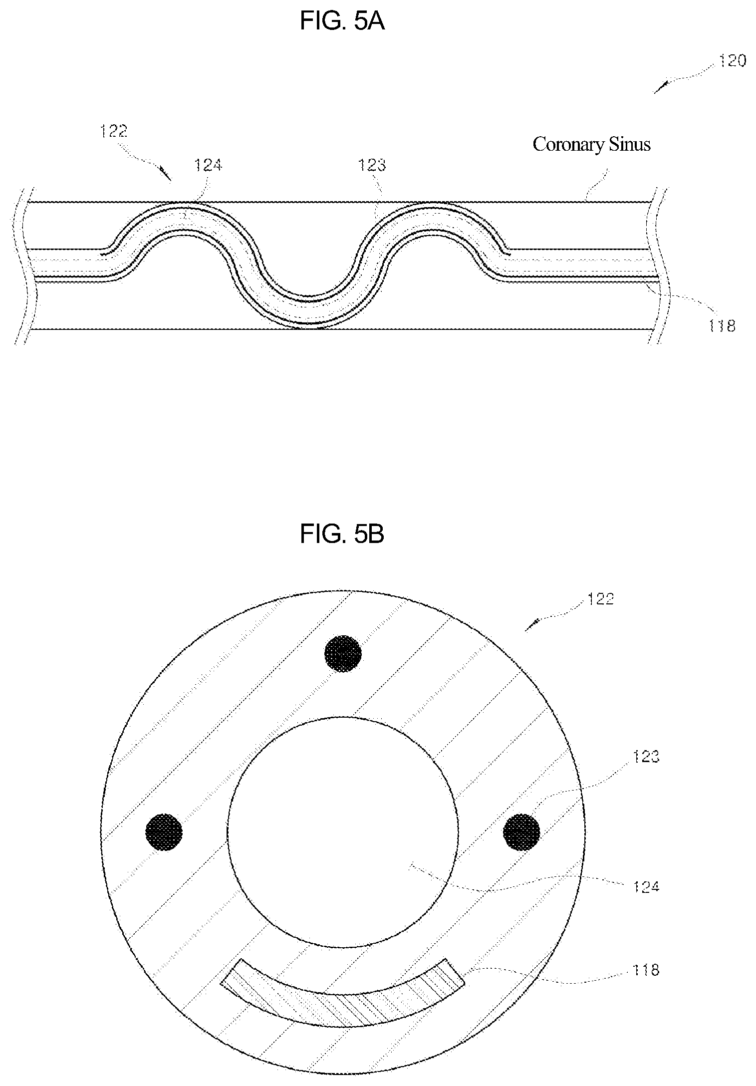 Patent US12090329 Figure 6 – Pacemaker lead for cerclage pacing