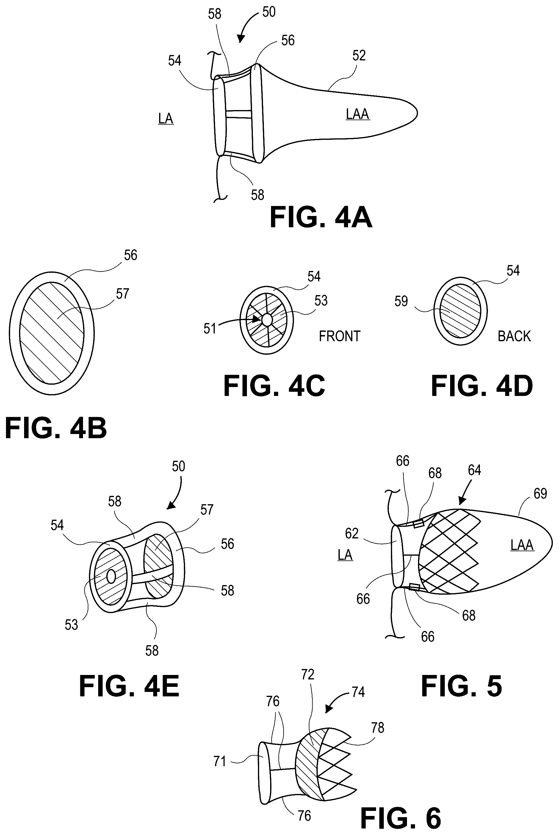 Patent US12090331 Figure 2 – Atrial appendage occlusion and arrhythmia treatment