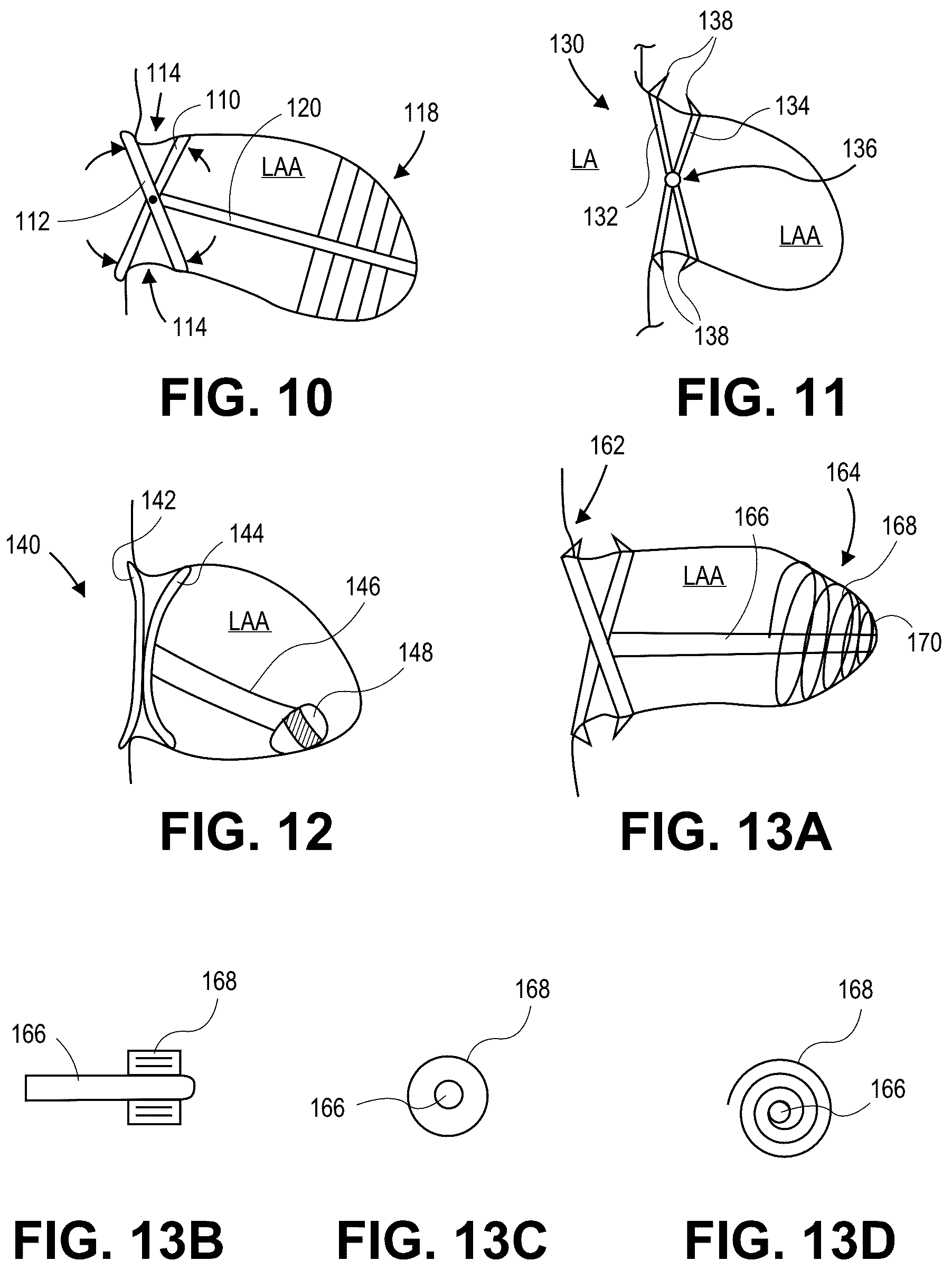 Patent US12090331 Figure 4 – Atrial appendage occlusion and arrhythmia treatment