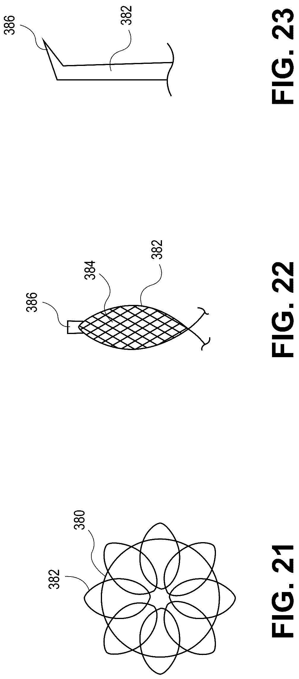 Patent US12090331 Figure 11 – Atrial appendage occlusion and arrhythmia treatment