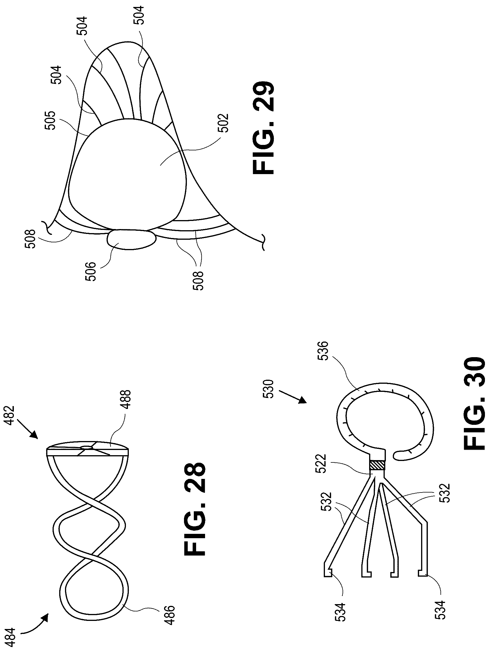 Patent US12090331 Figure 13 – Atrial appendage occlusion and arrhythmia treatment