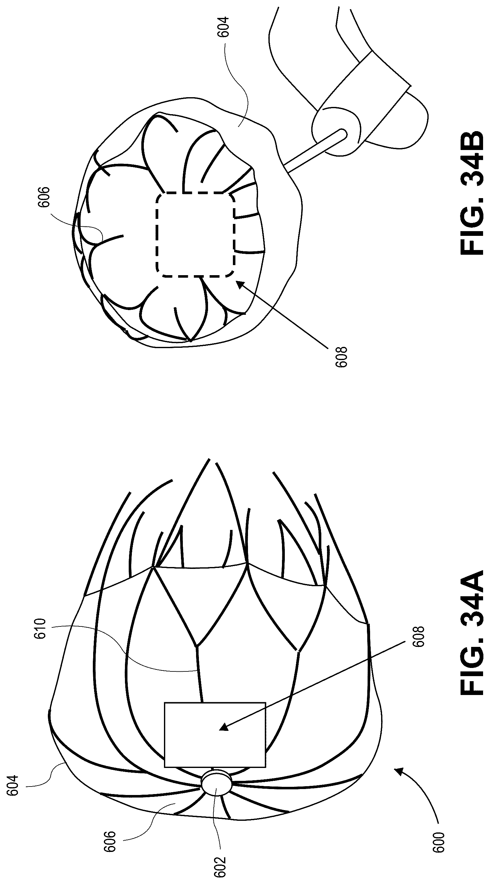 Patent US12090331 Figure 16 – Atrial appendage occlusion and arrhythmia treatment
