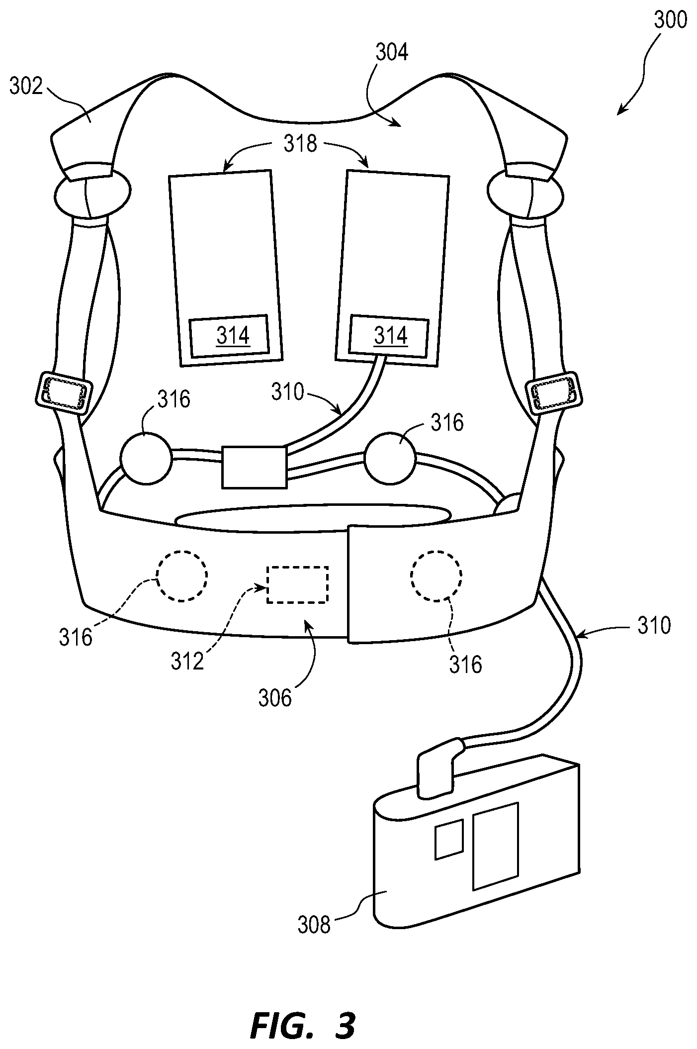 Patent US12090333 Figure 3 – Managing alerts in a WCD system