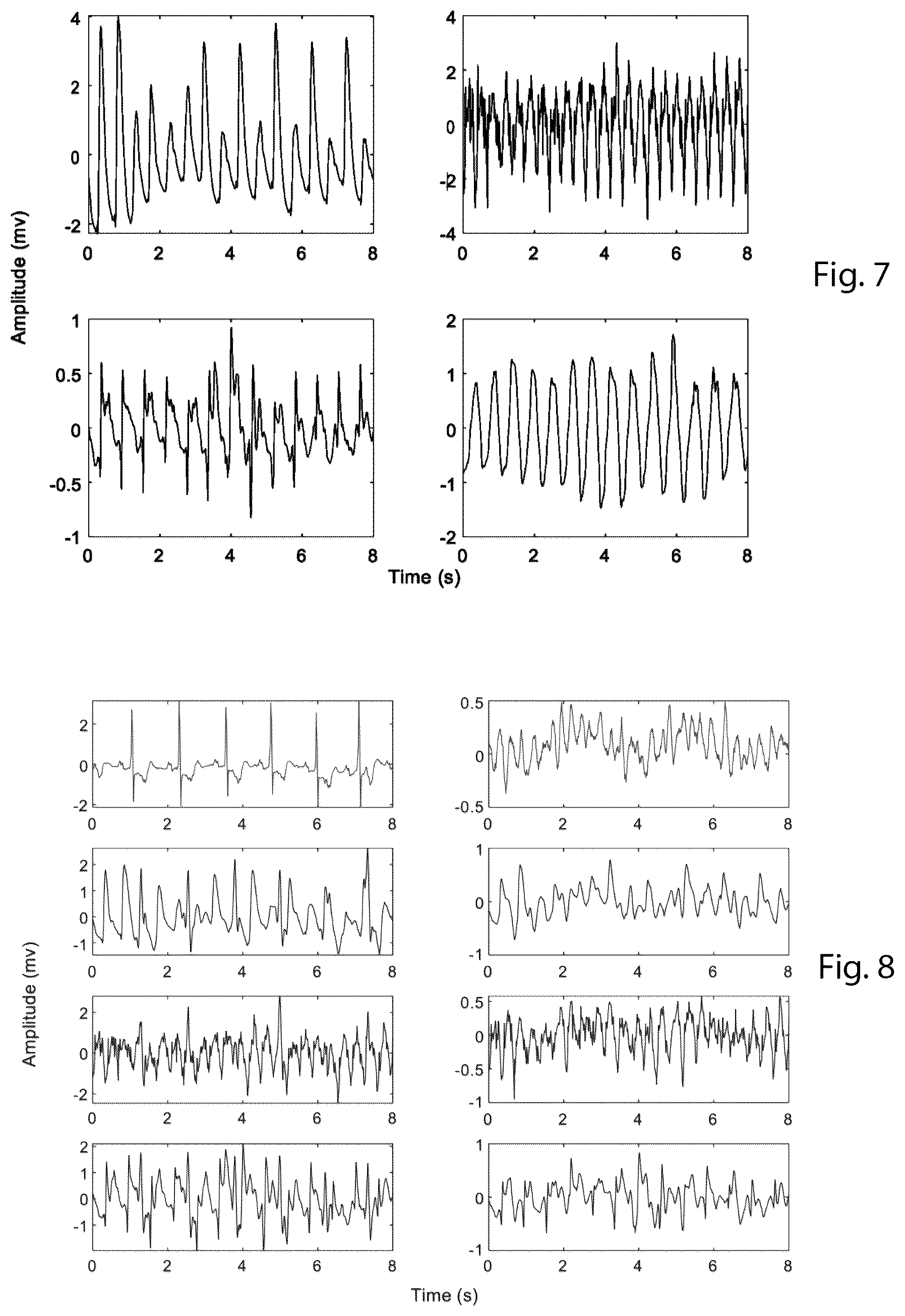Patent US12090334 Figure 6 – Automated external defibrillation with deep neural network