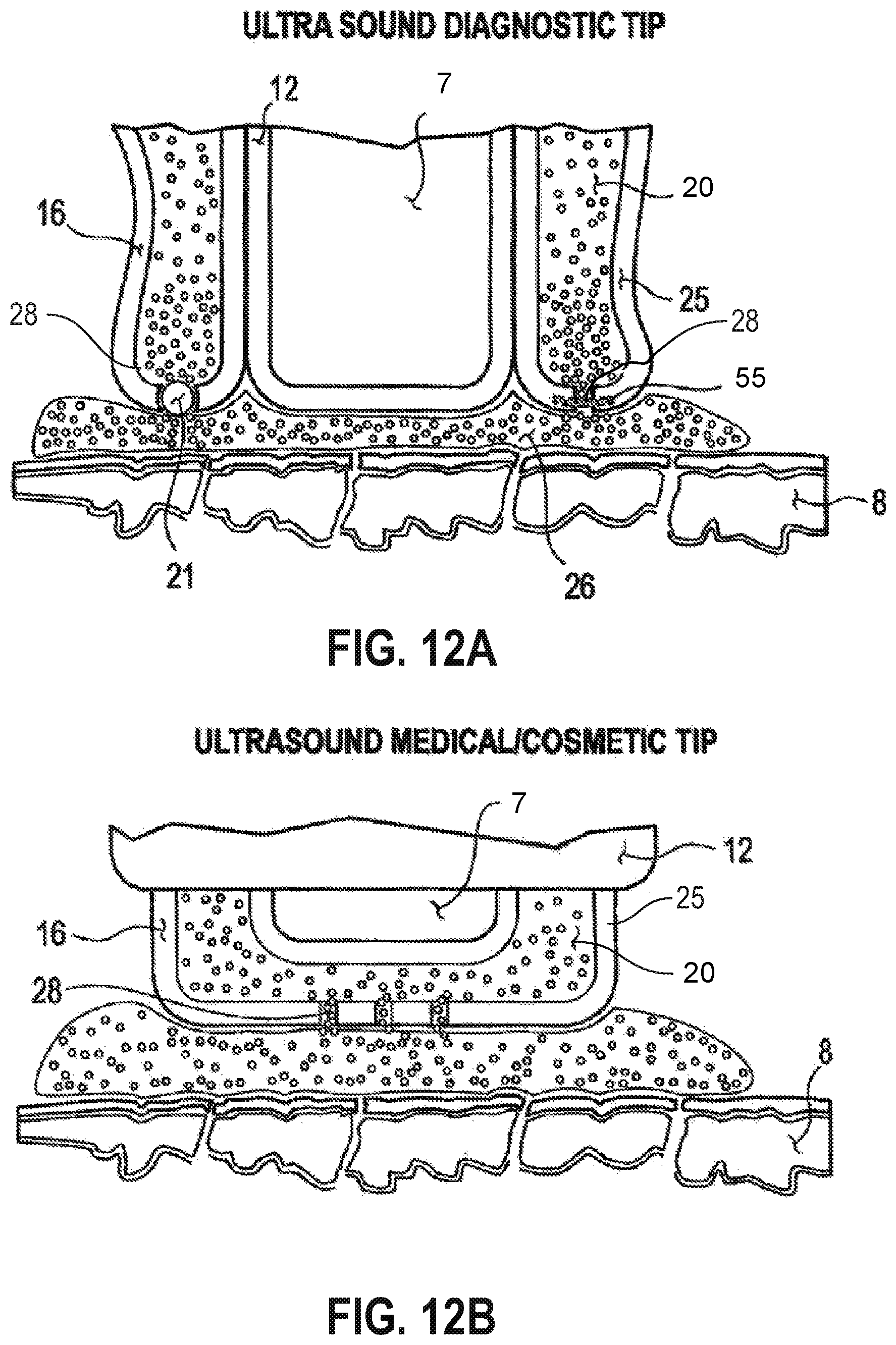 Patent US12090335 Figure 9 – Attachable tip for electromagnetic hand piece