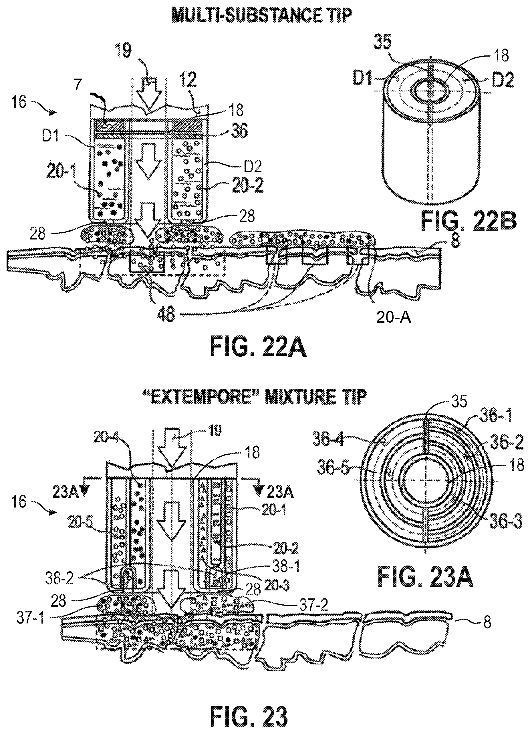 Patent US12090335 Figure 17 – Attachable tip for electromagnetic hand piece