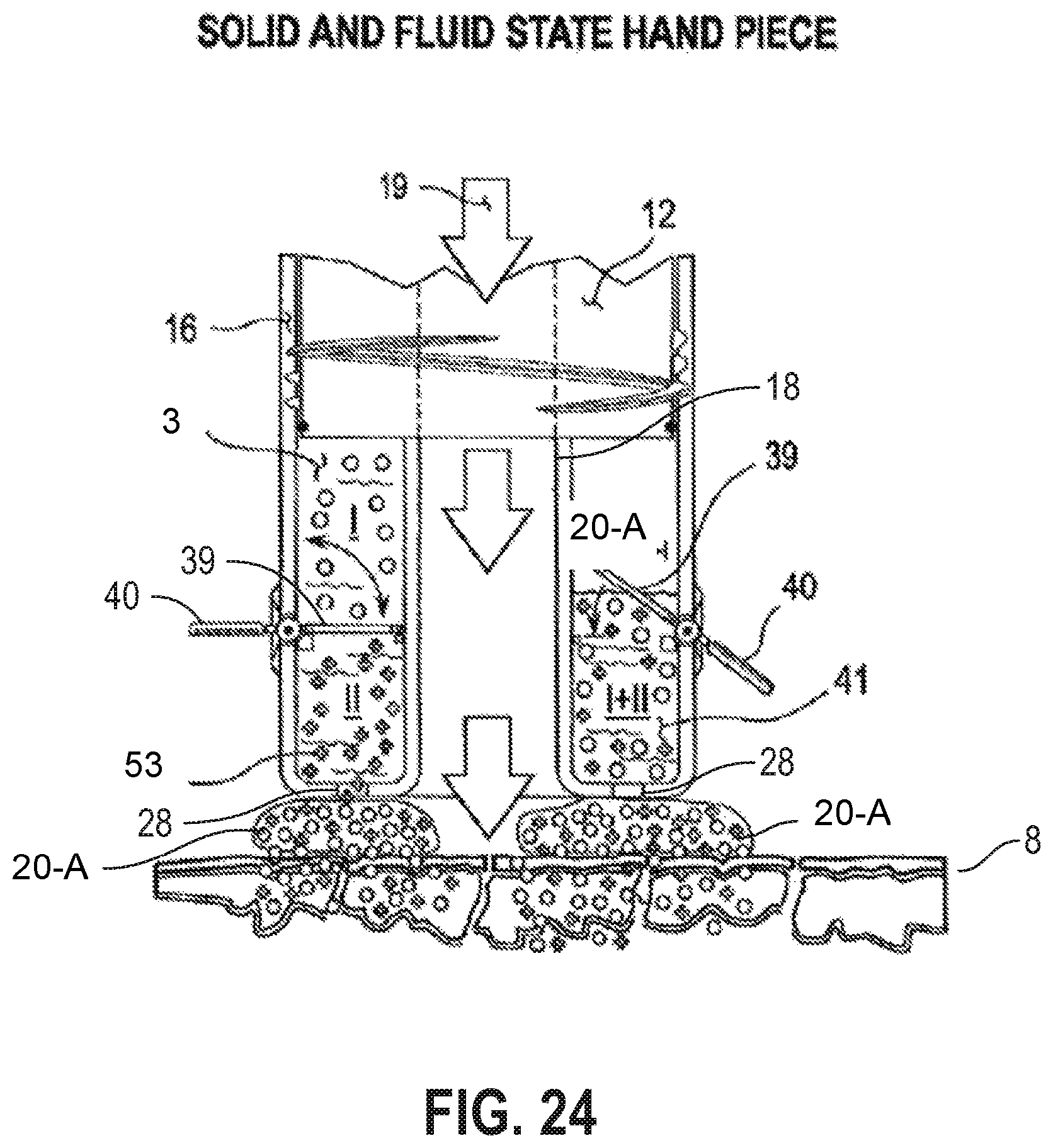 Patent US12090335 Figure 18 – Attachable tip for electromagnetic hand piece