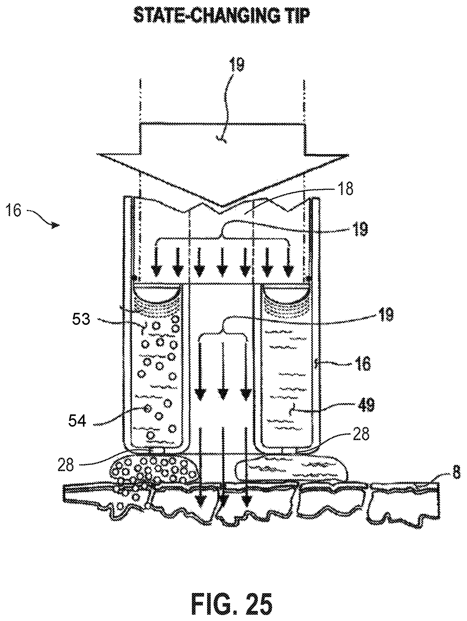 Patent US12090335 Figure 19 – Attachable tip for electromagnetic hand piece