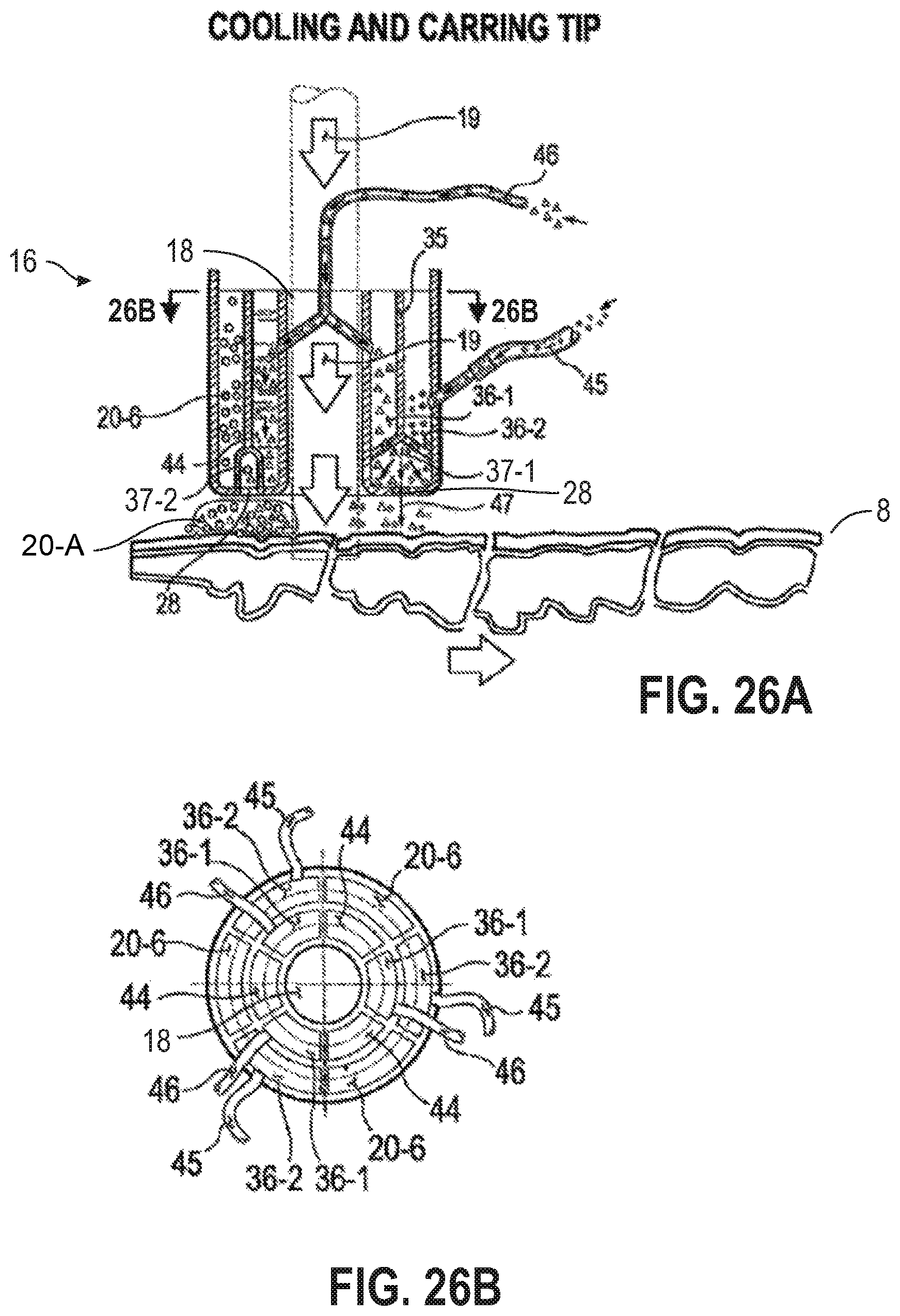 Patent US12090335 Figure 20 – Attachable tip for electromagnetic hand piece