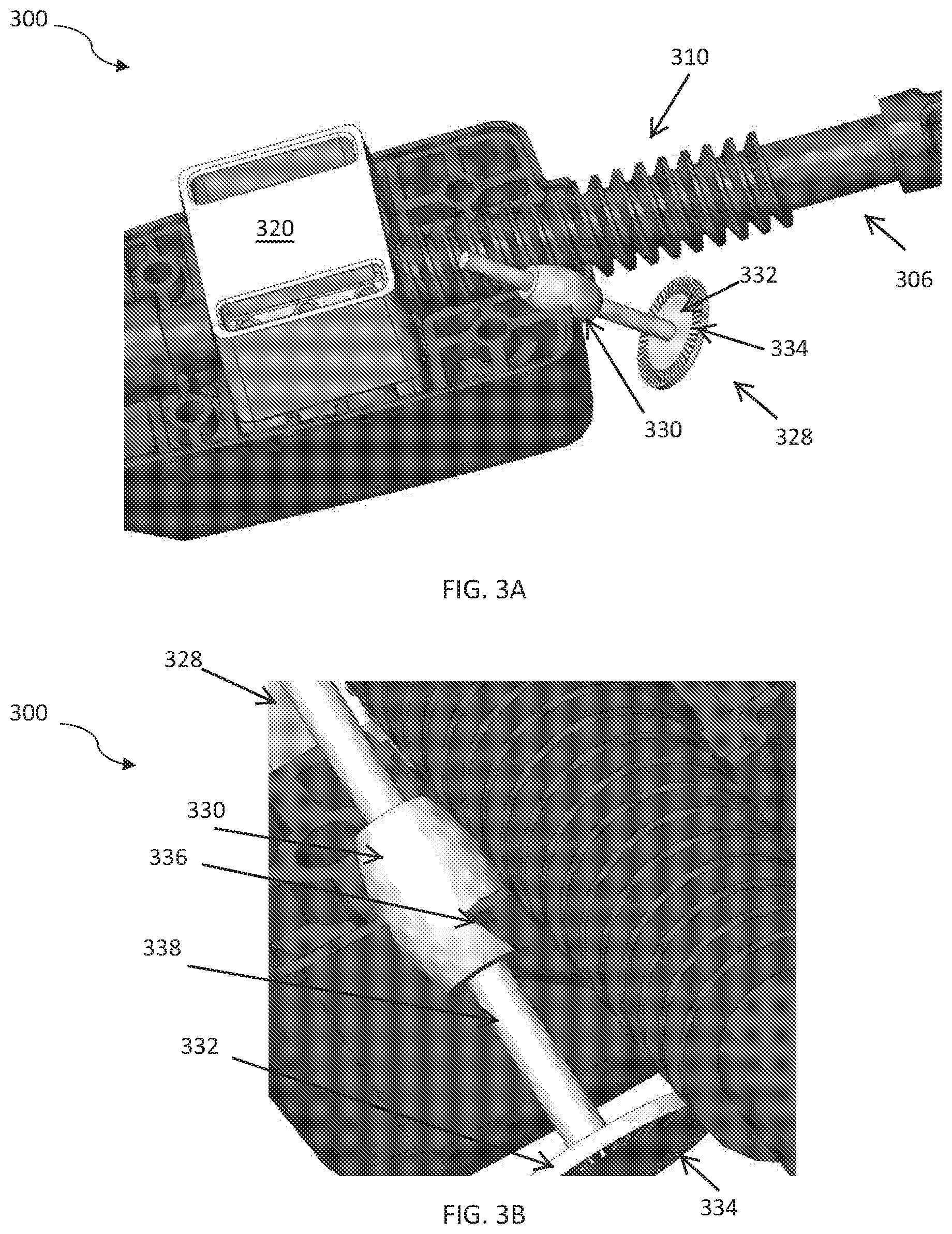 Patent US12090337 Figure 3 – Systems and methods for determining flow parameters of administered fluid from radioembolization delivery device