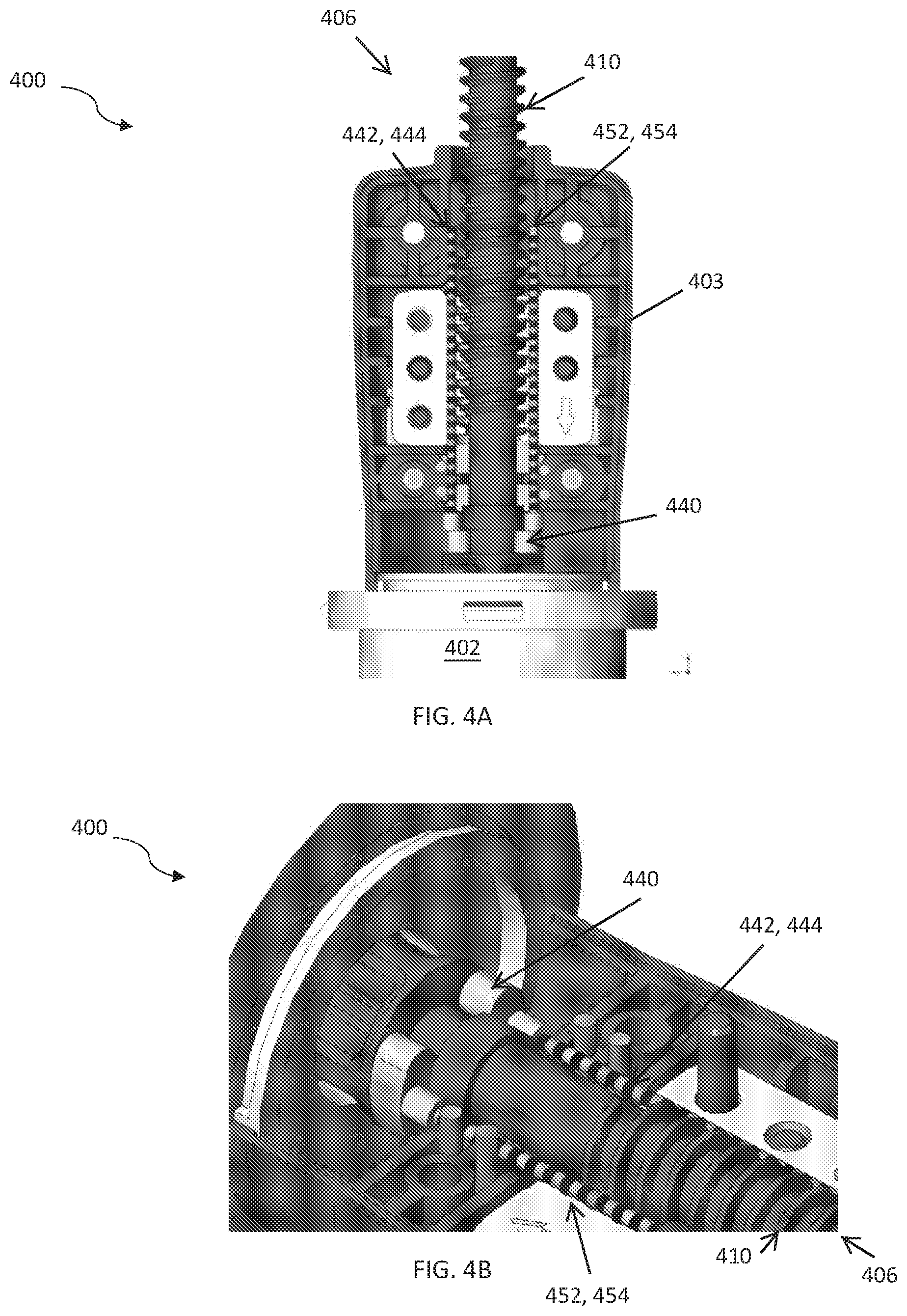 Patent US12090337 Figure 4 – Systems and methods for determining flow parameters of administered fluid from radioembolization delivery device