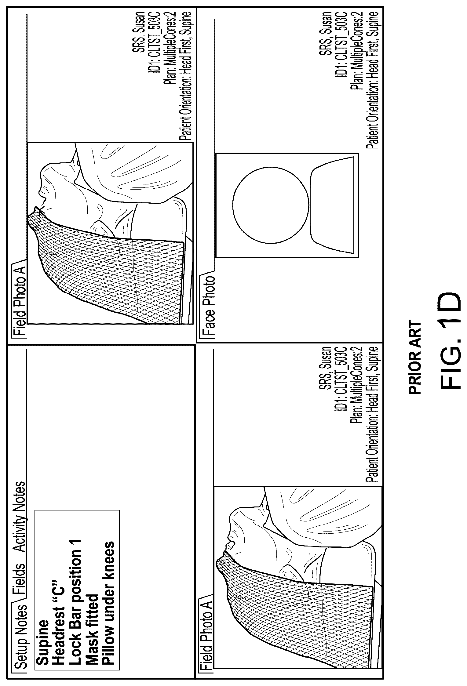 Patent US12090342 Figure 4 – Radiotherapy methods, systems, and workflow-oriented graphical user interfaces