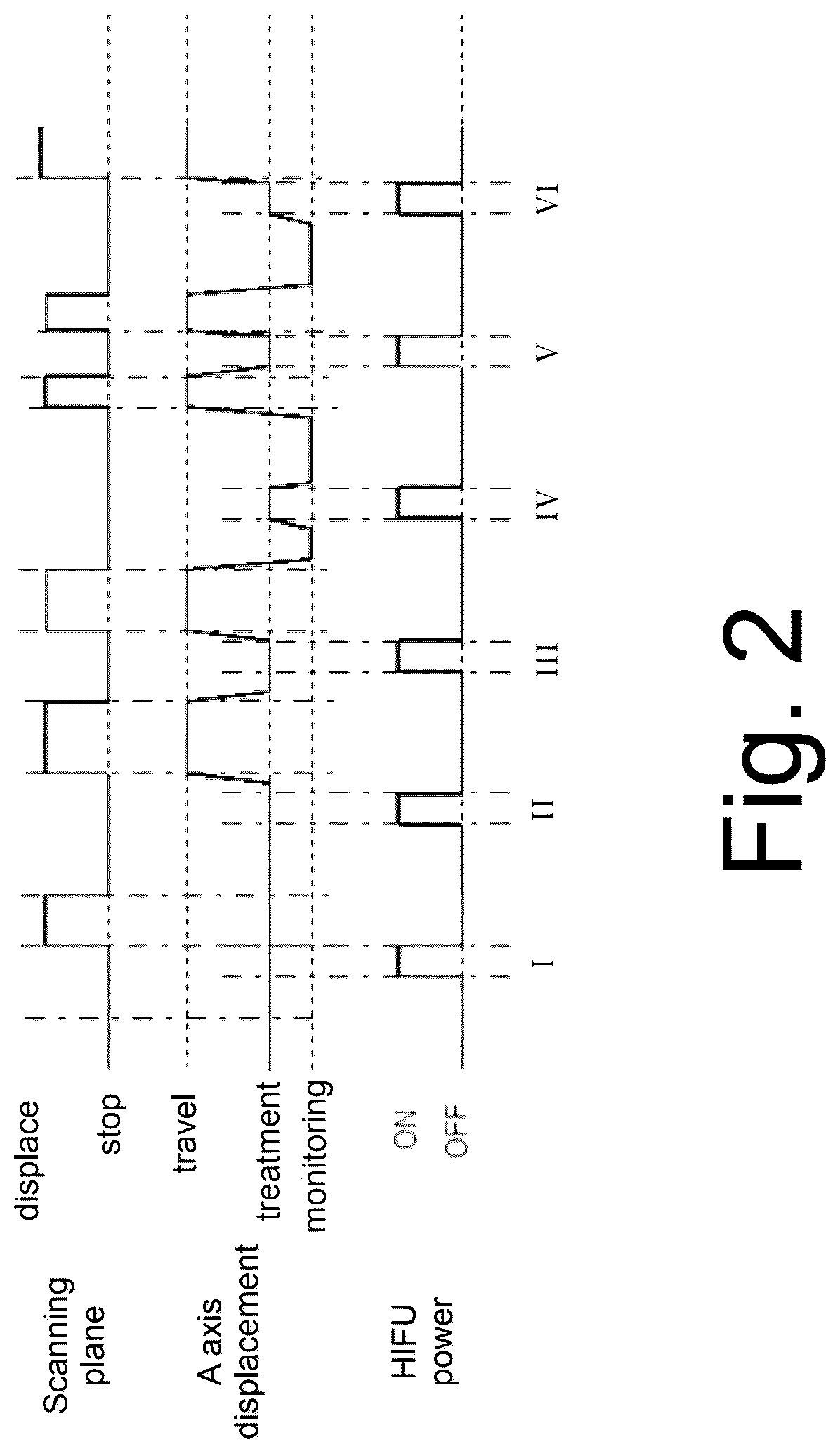 Patent US12090345 Figure 2 – Device for treatment of a tissue and method of preparation of an image of an image-guided device for treatment of a tissue