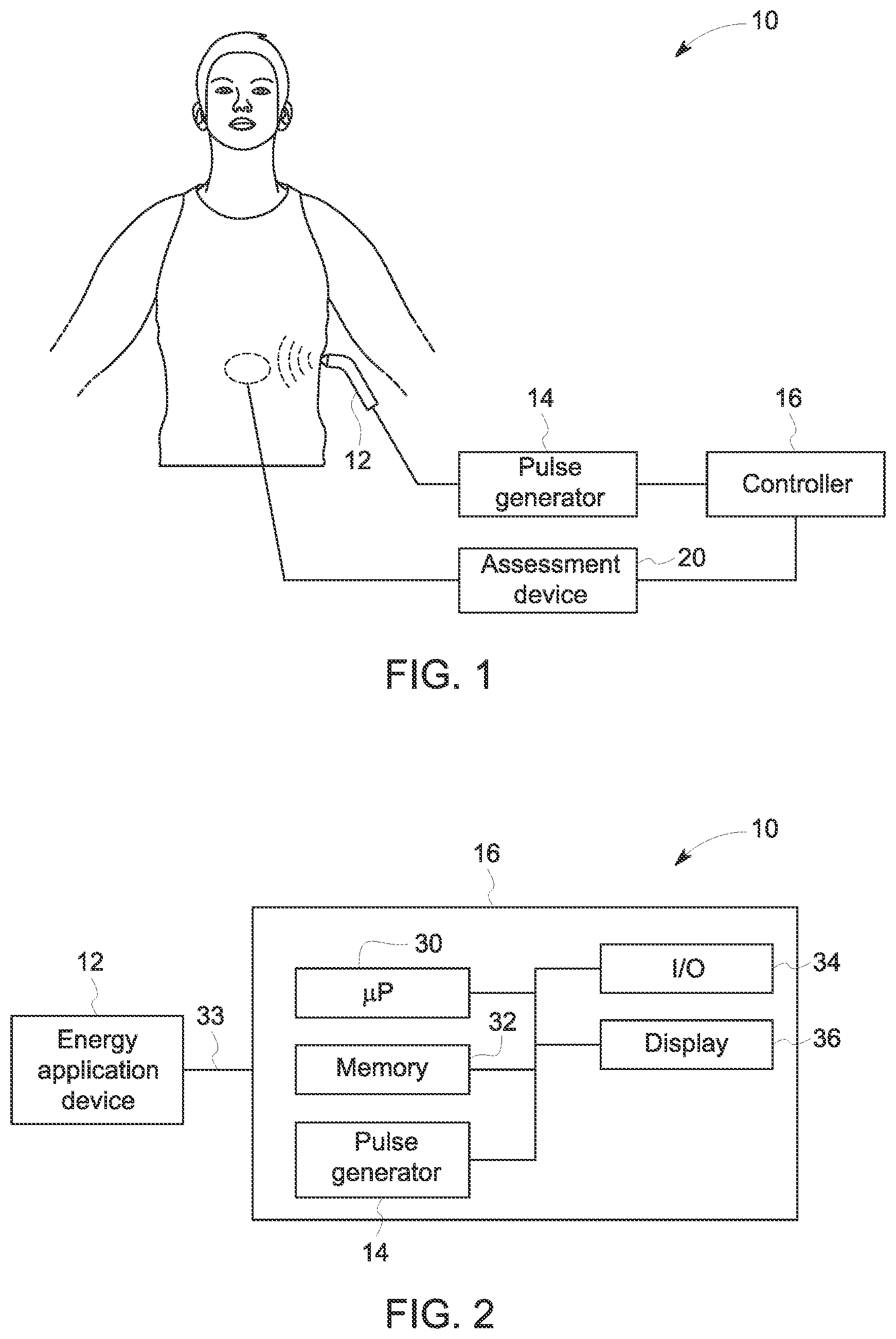 Patent US12090346 — Neuromodulation techniques — Figure 1