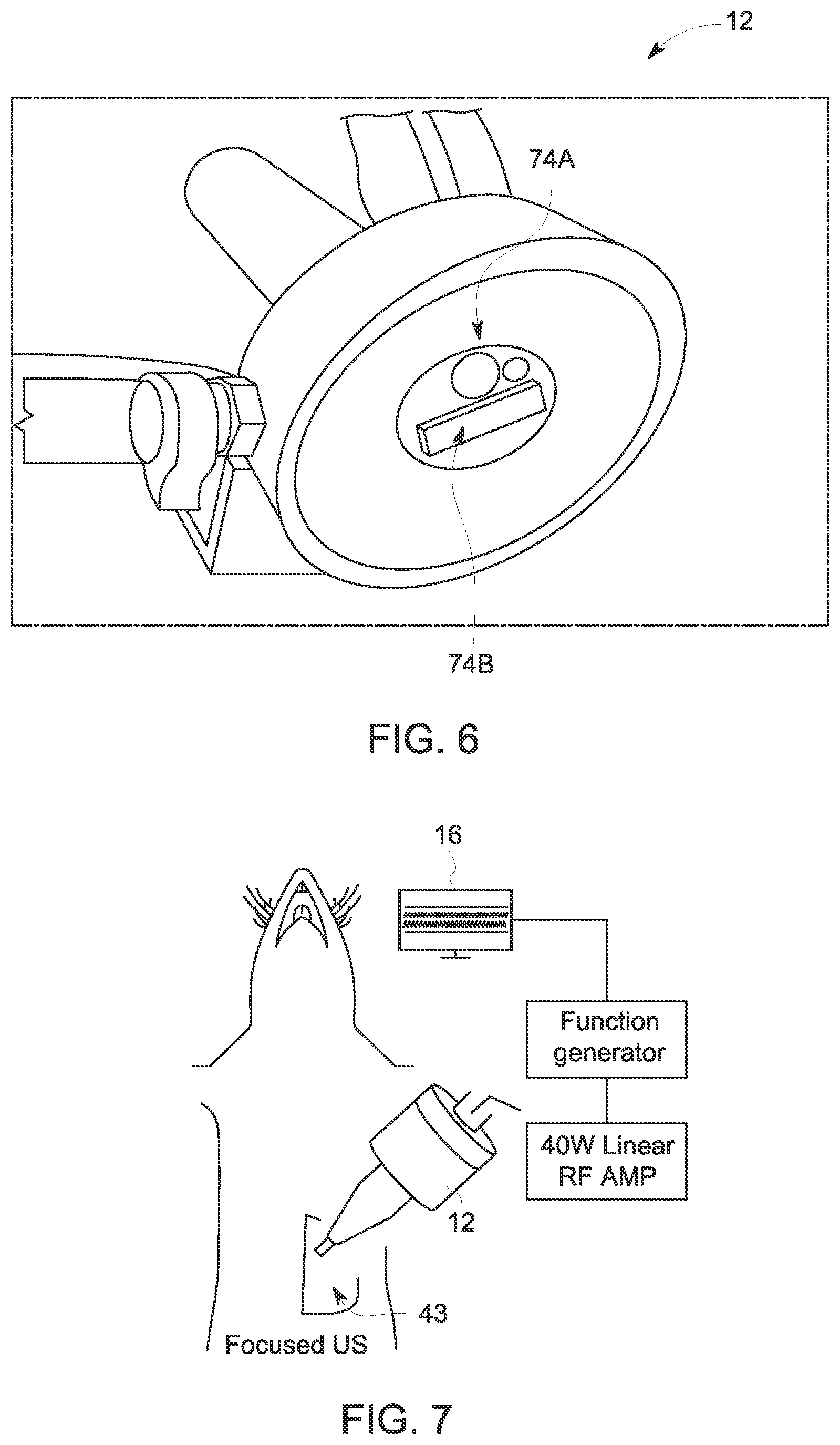 Patent US12090346 Figure 4 – Neuromodulation techniques