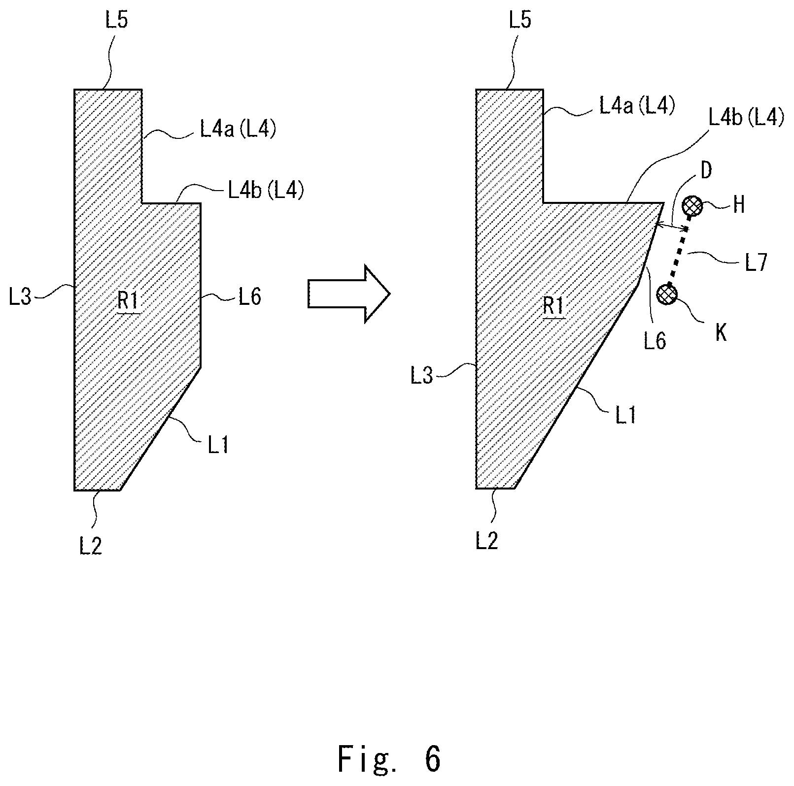Patent US12090362 Figure 6 – Extraction system, walking training system, extraction method, and extraction program