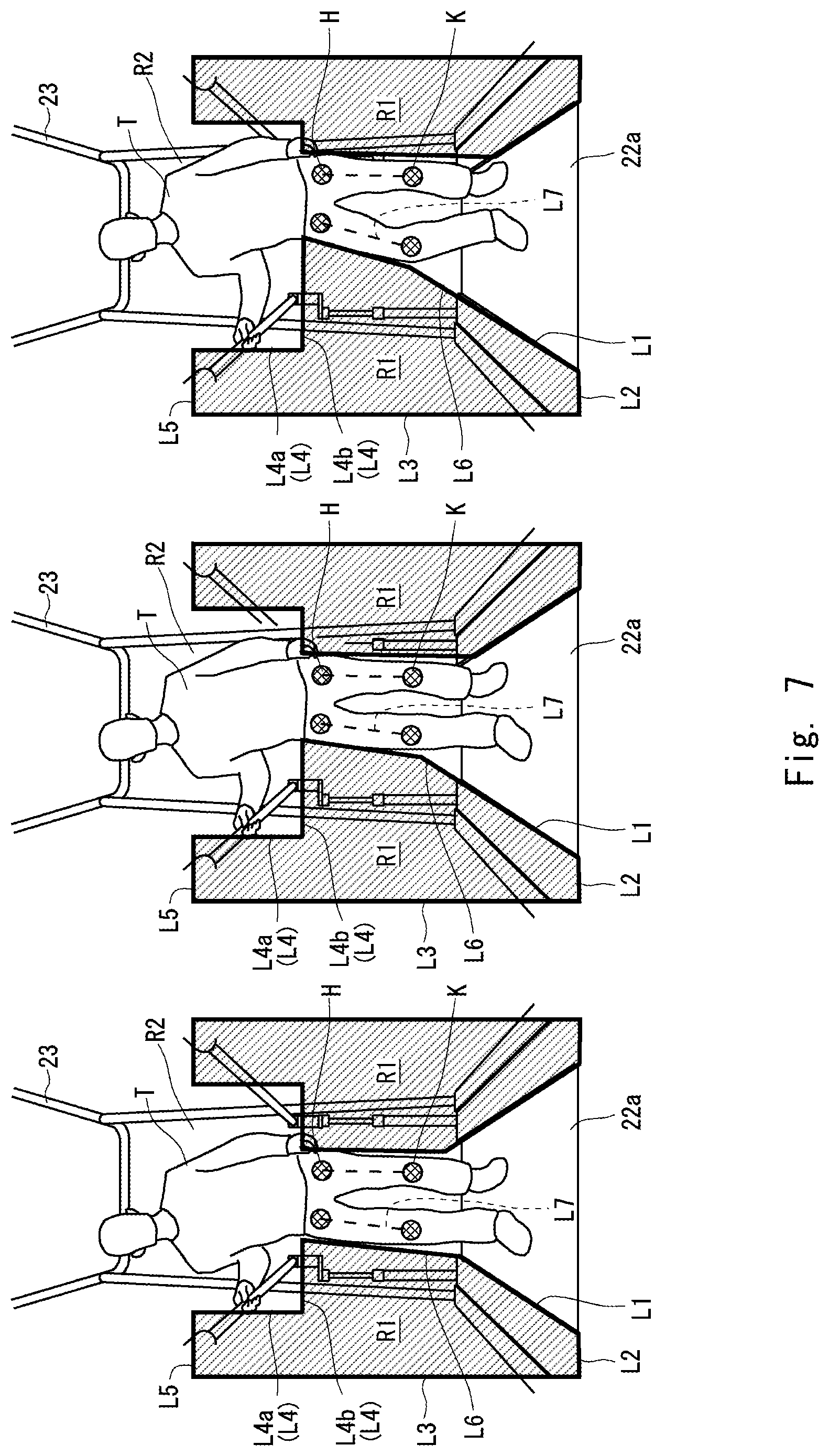 Patent US12090362 Figure 7 – Extraction system, walking training system, extraction method, and extraction program