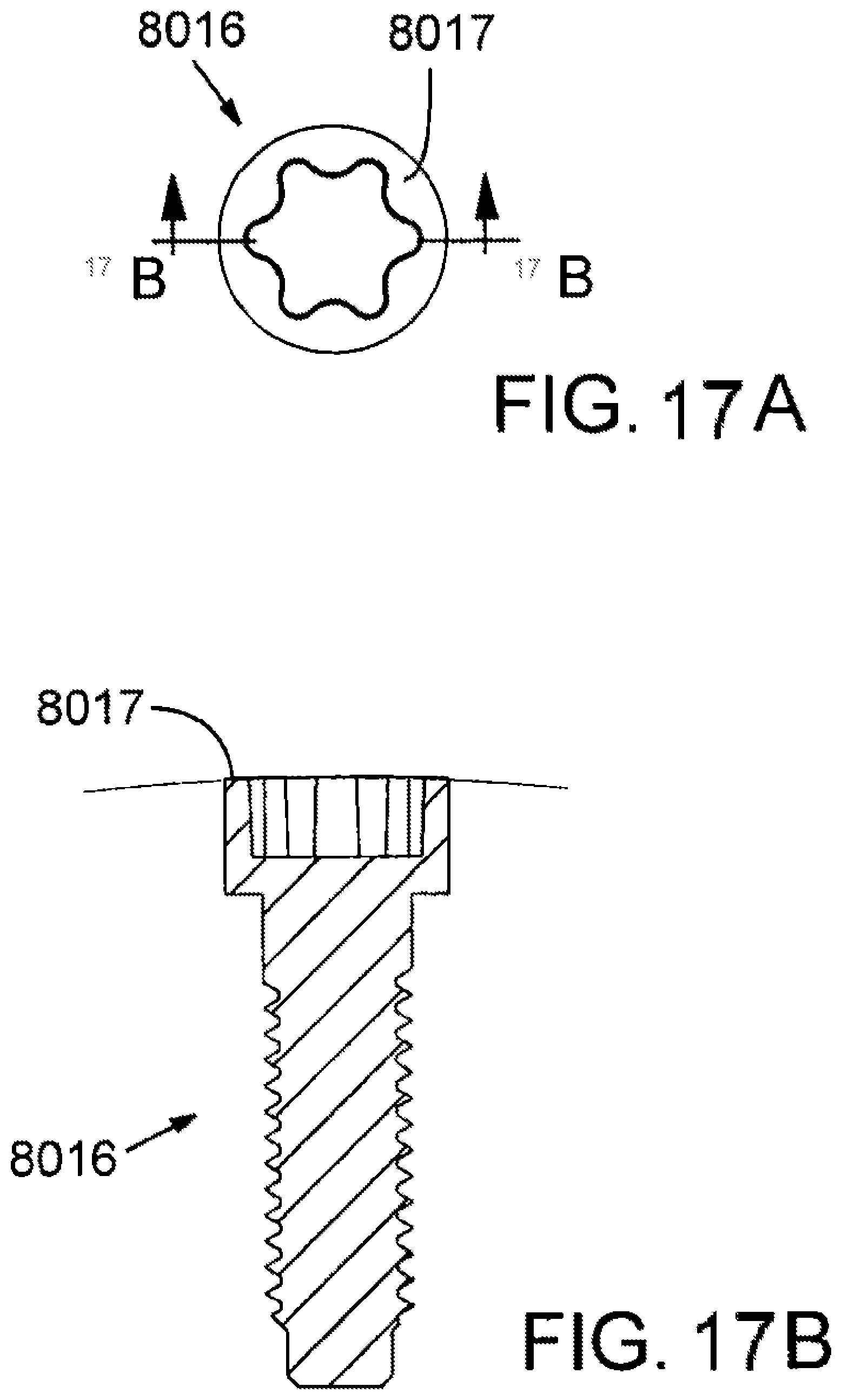 Patent US12090372 Figure 15 – Golf club head