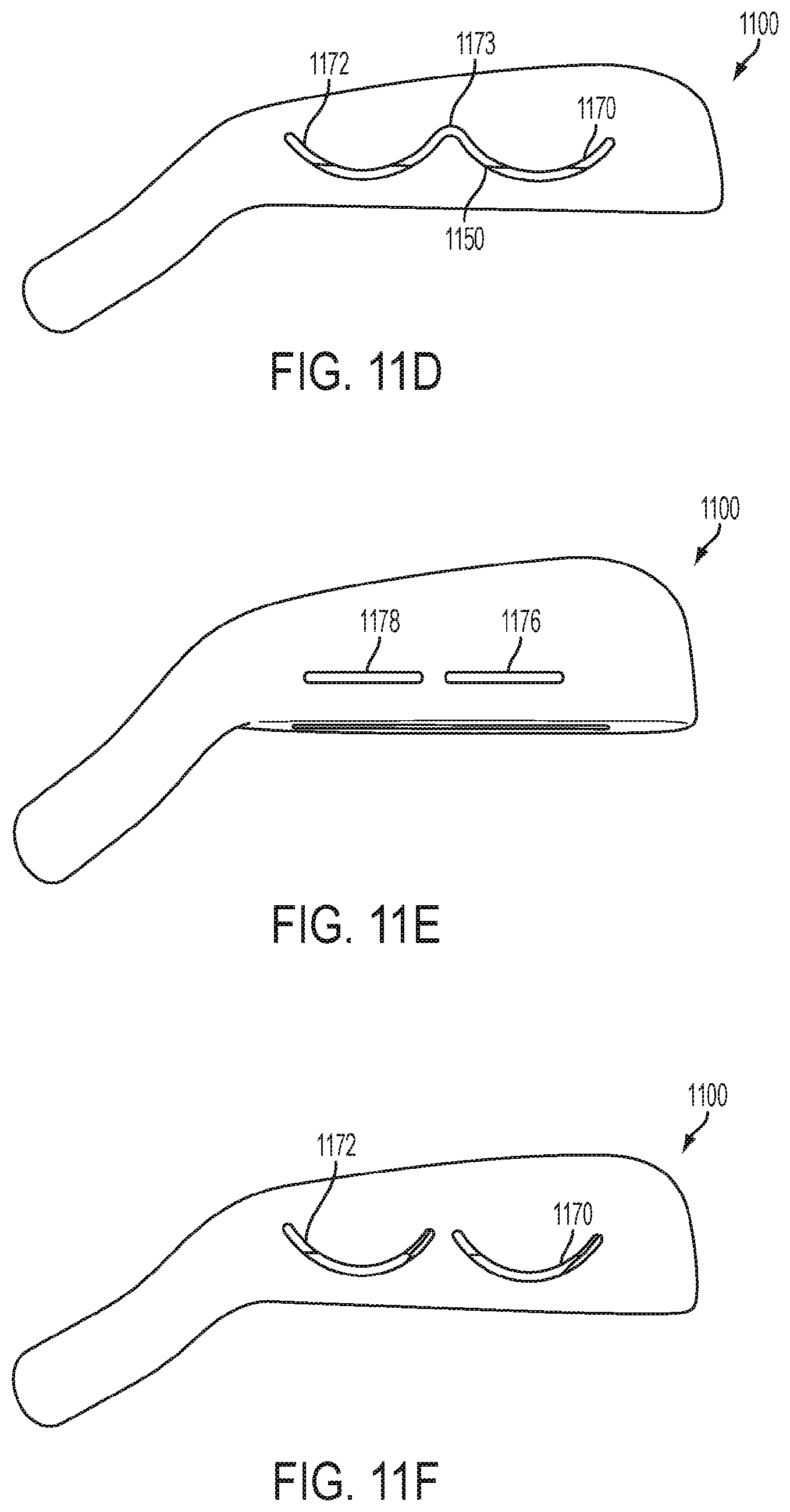 Patent US12090373 Figure 17 – Iron type golf club head