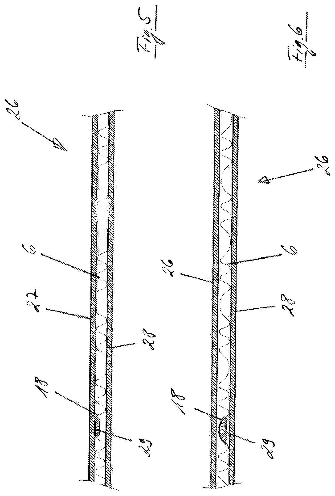 Patent US12090682 Figure 5 – Method and system for producing a three-dimensionally deformed plate