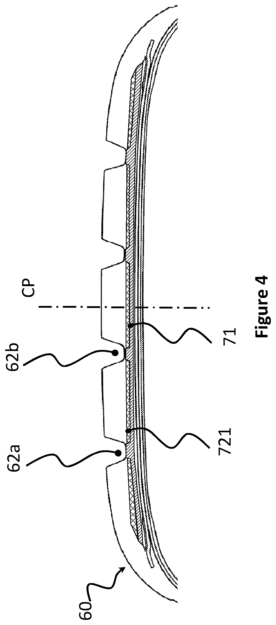 Patent US12090790 Figure 4 – Tire with a tread sub-layer containing multiple materials