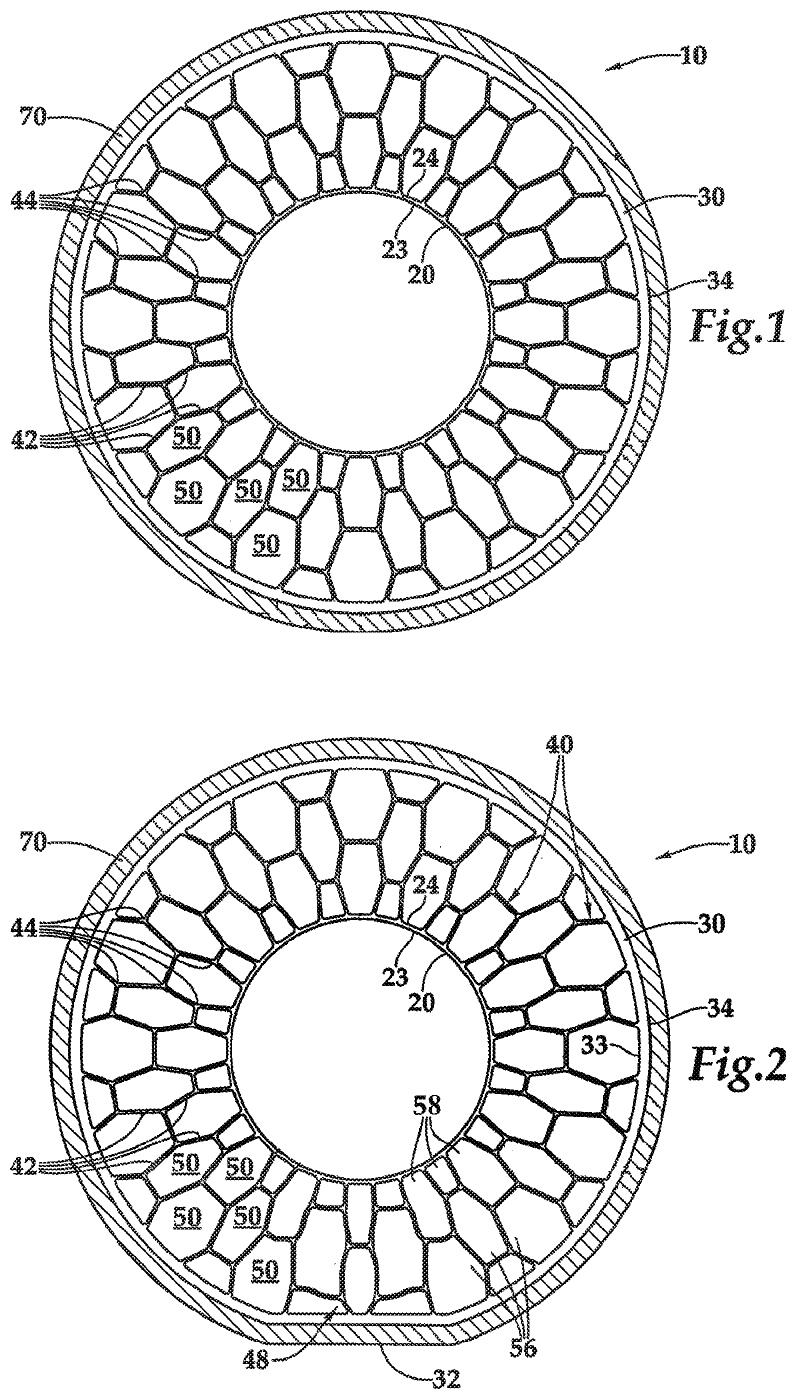Patent US12090801 Figure 1 – Non-pneumatic tire having reinforced outer ring