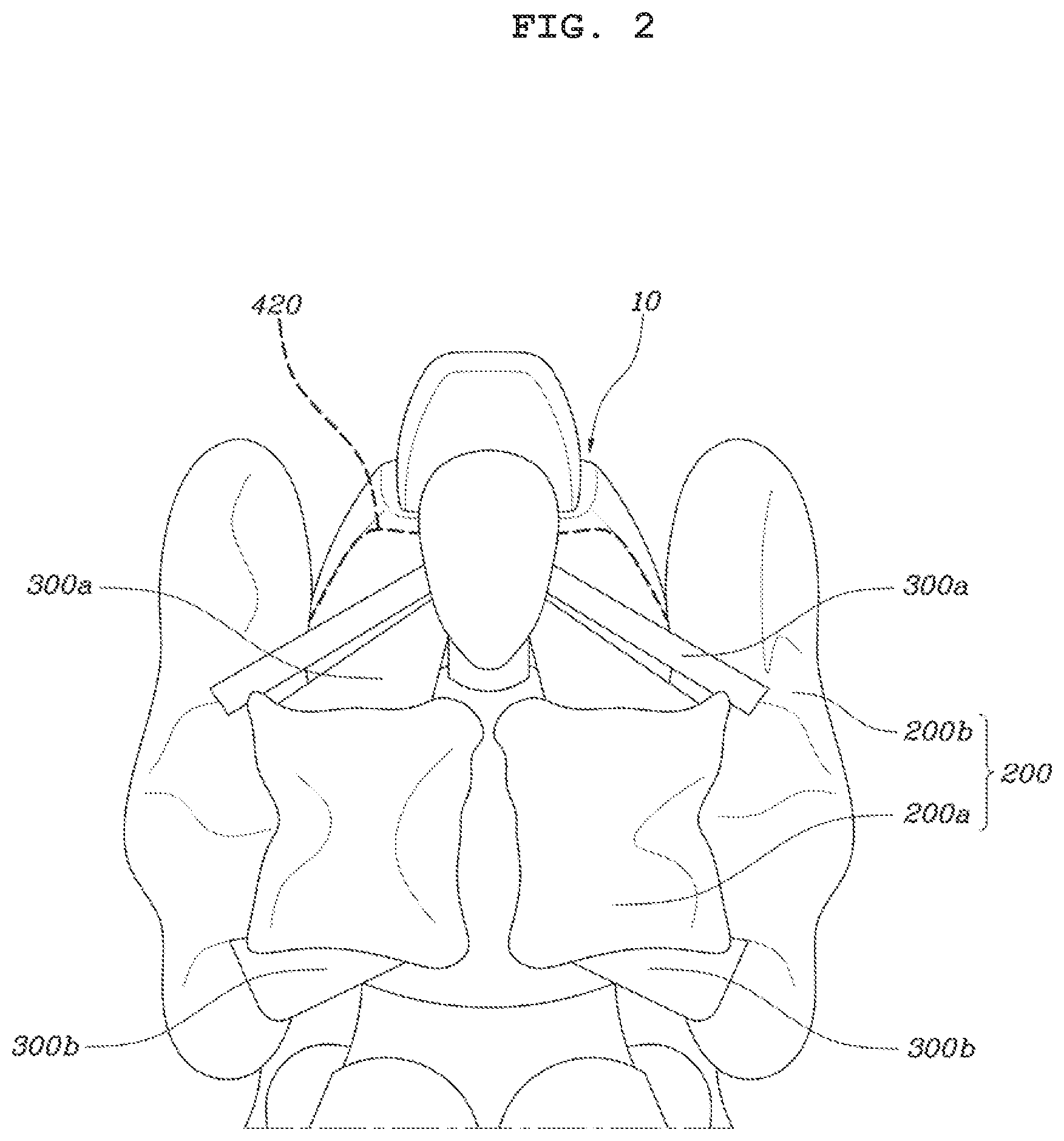 Patent US12090948 Figure 2 – Airbag device