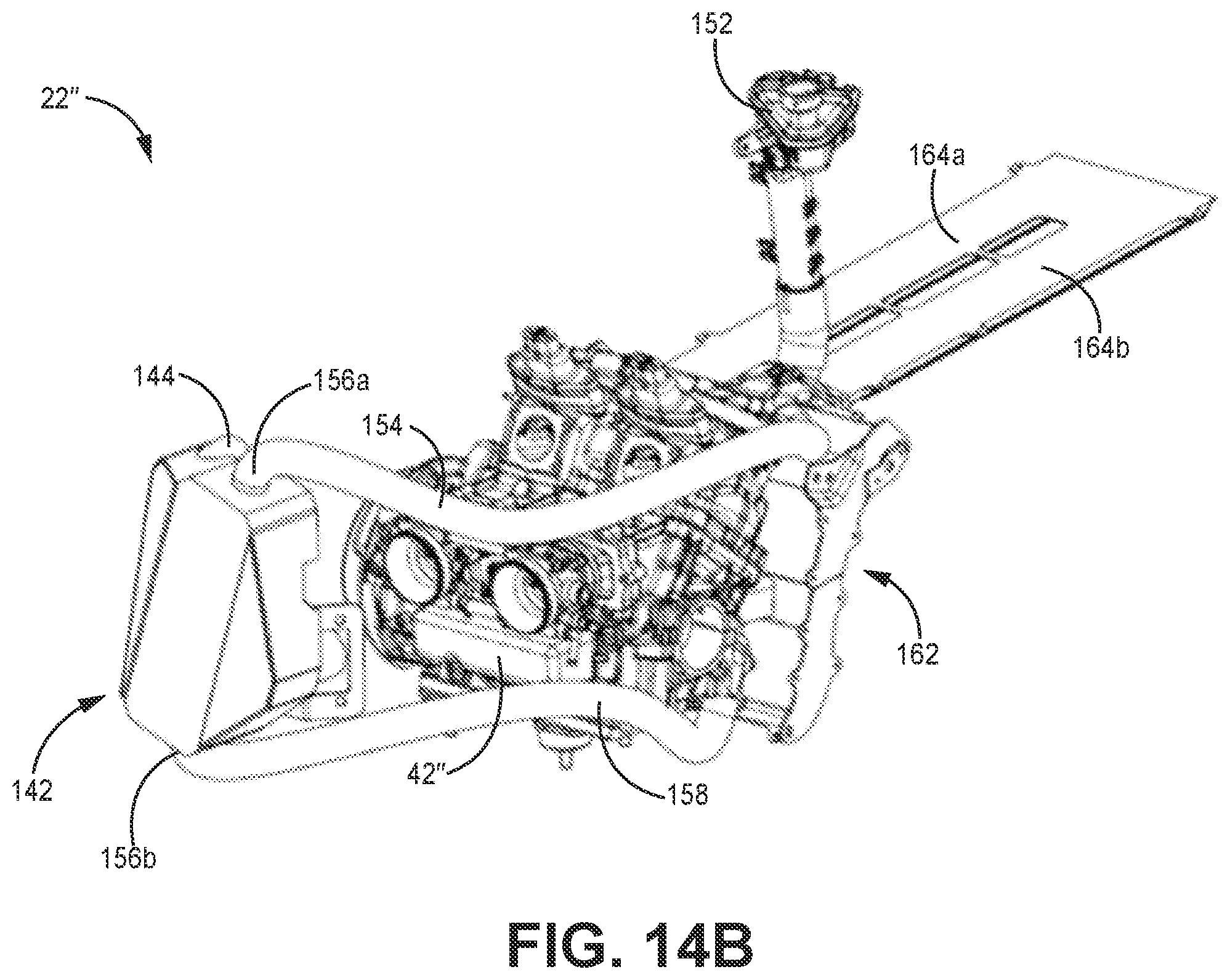 Patent US12092005 Figure 17 – Snowmobile having a parallel-path exhaust system for two-stroke engine