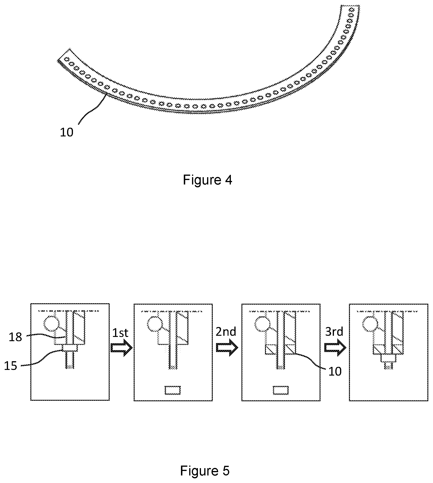 Patent US12092075 Figure 3 – Method of prolonging pitch bearing lifetime and pitch bearing