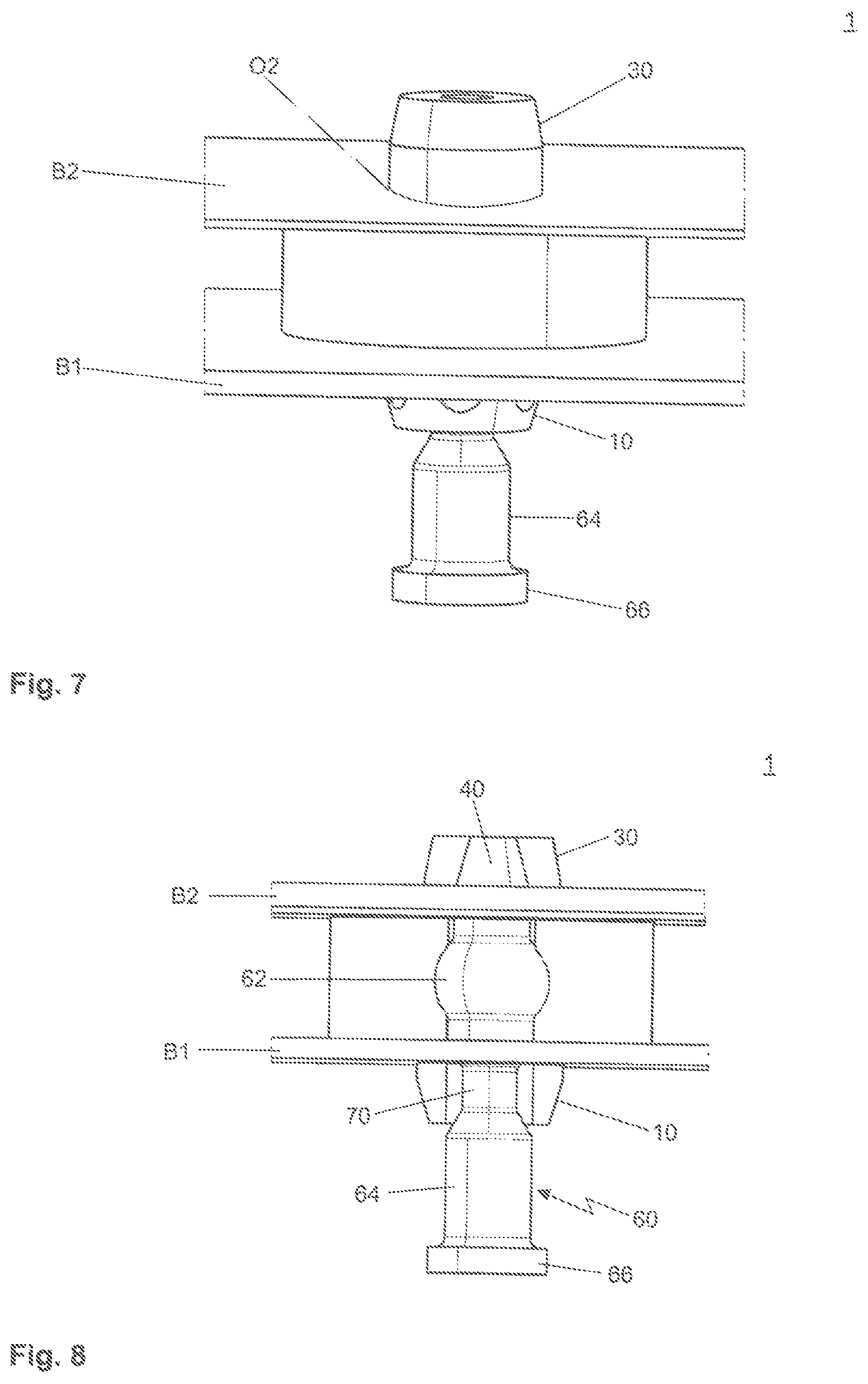 Patent US12092149 Figure 4 – Resilient connecting block, connecting pin therefor, and a connection between two components via the resilient connecting block