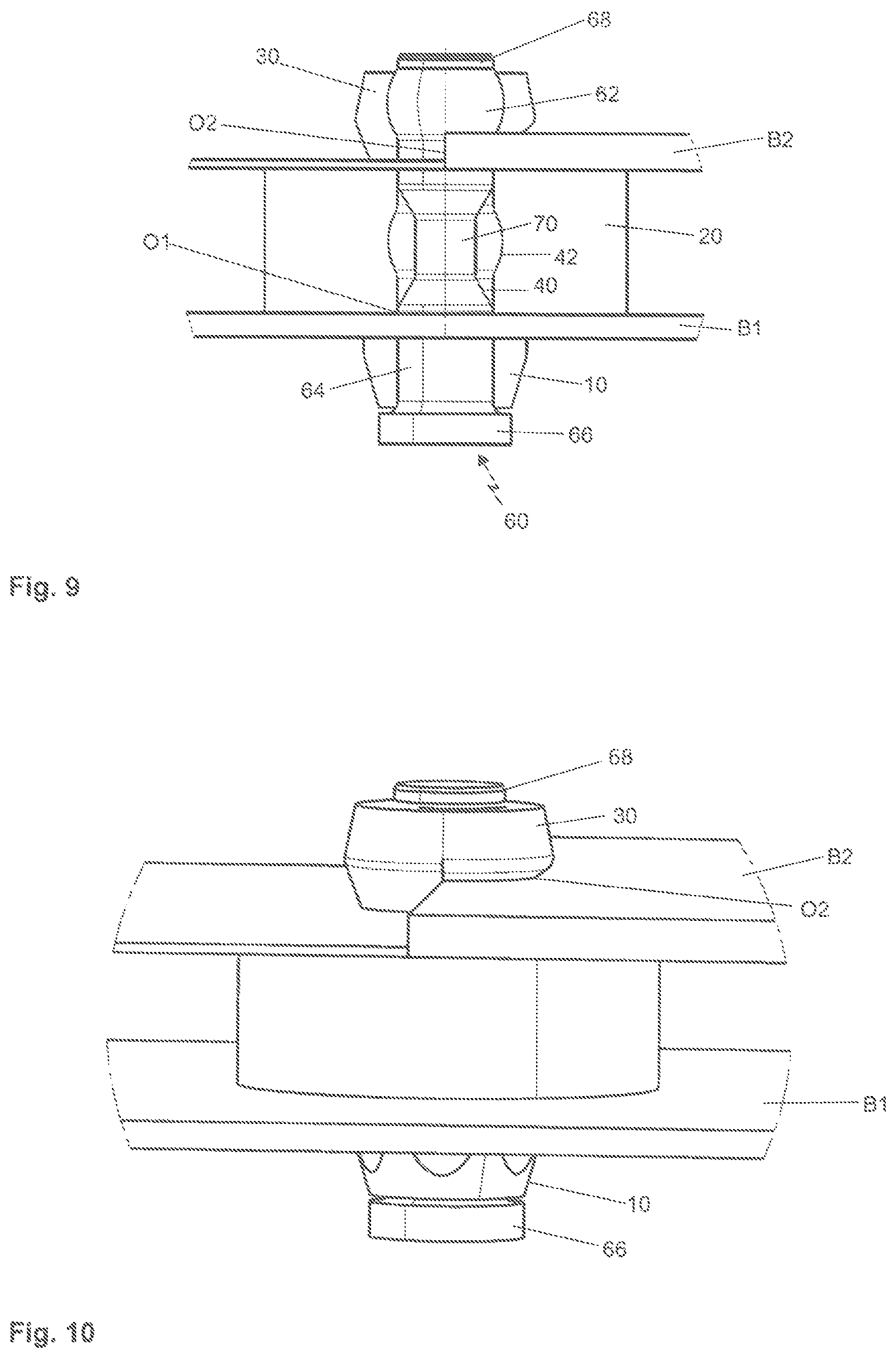 Patent US12092149 Figure 5 – Resilient connecting block, connecting pin therefor, and a connection between two components via the resilient connecting block