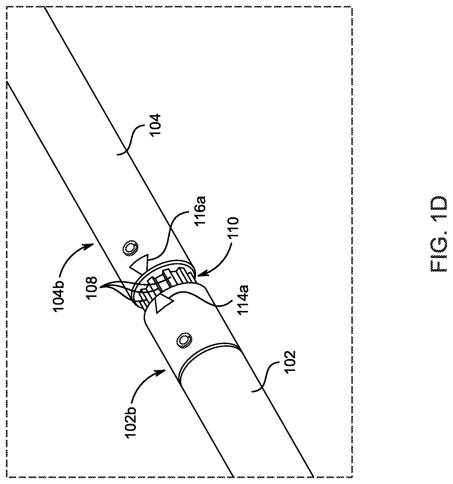 Patent US12092155 Figure 4 – Quick-change split shaft