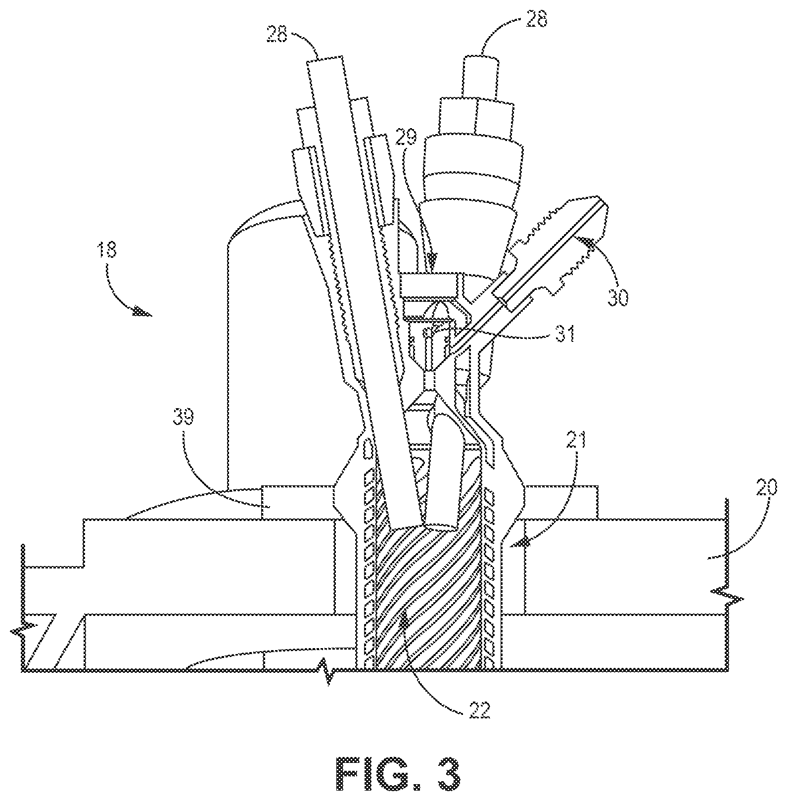Patent US12092333 Figure 3 – Radially oriented internally mounted continuous ignition device