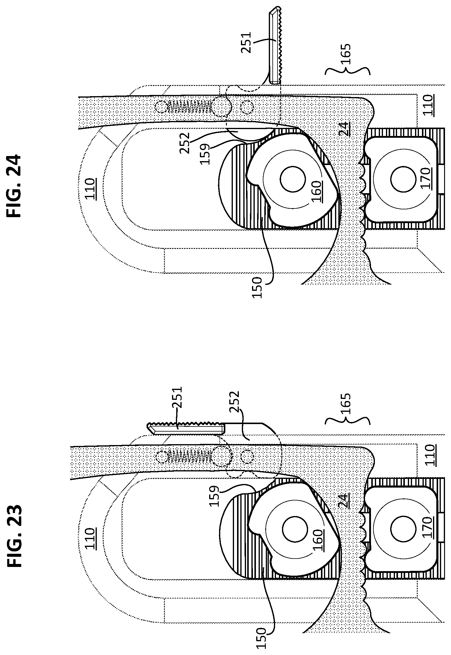 Patent US12092427 Figure 9 – Customizable locking and quick release mechanism and kit for handgun holsters