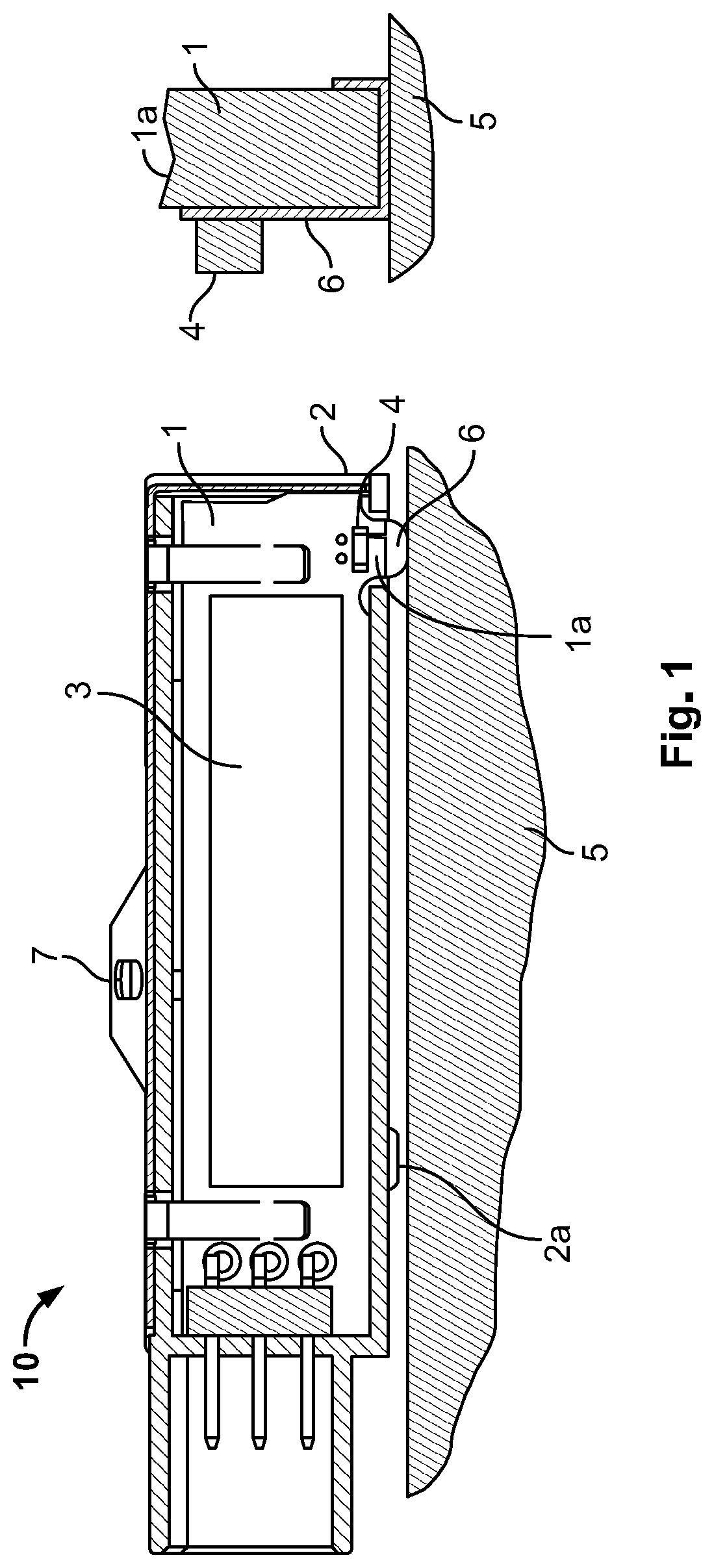 Patent US12092527 — Temperature sensor device for a windshield of a vehicle — Figure 1