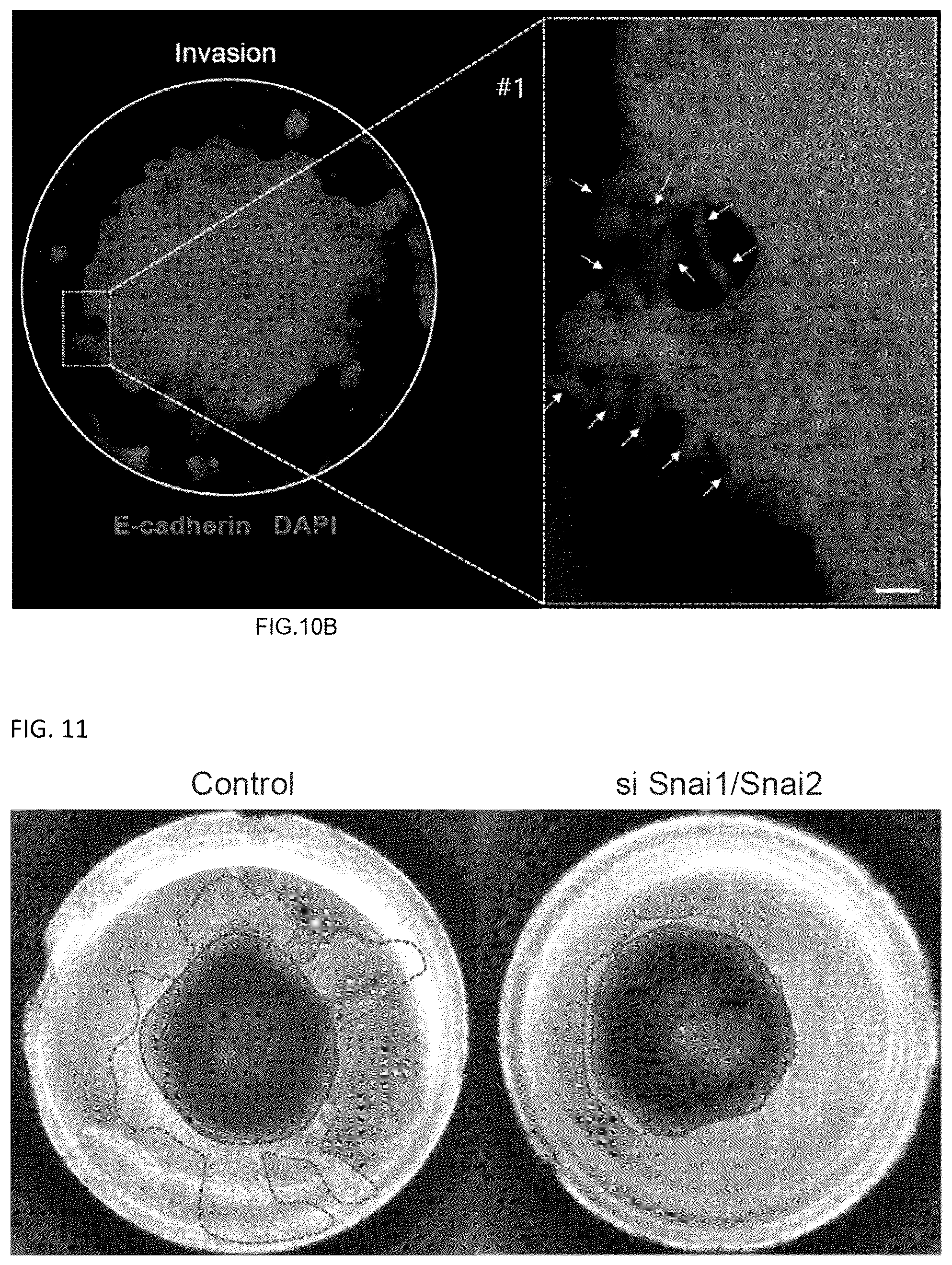 Patent US12092575 Figure 11 – Measuring method of cell migration using the rate of cell invasion