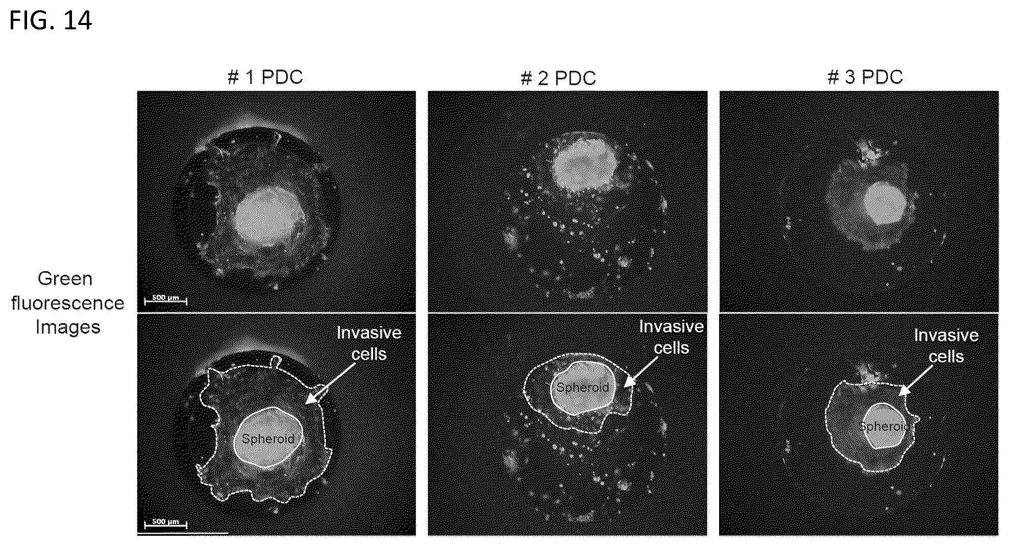 Patent US12092575 Figure 14 – Measuring method of cell migration using the rate of cell invasion