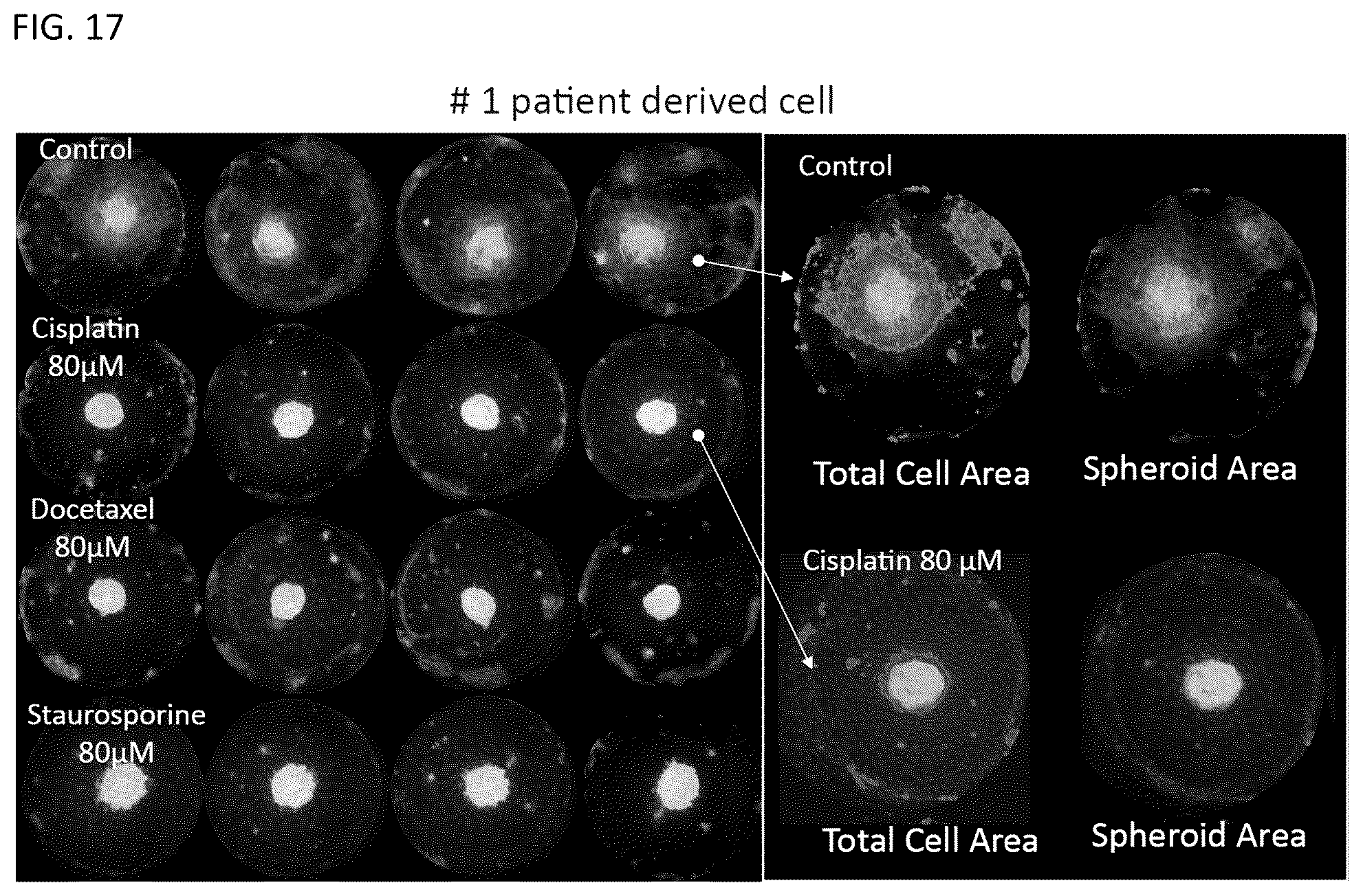 Patent US12092575 Figure 17 – Measuring method of cell migration using the rate of cell invasion