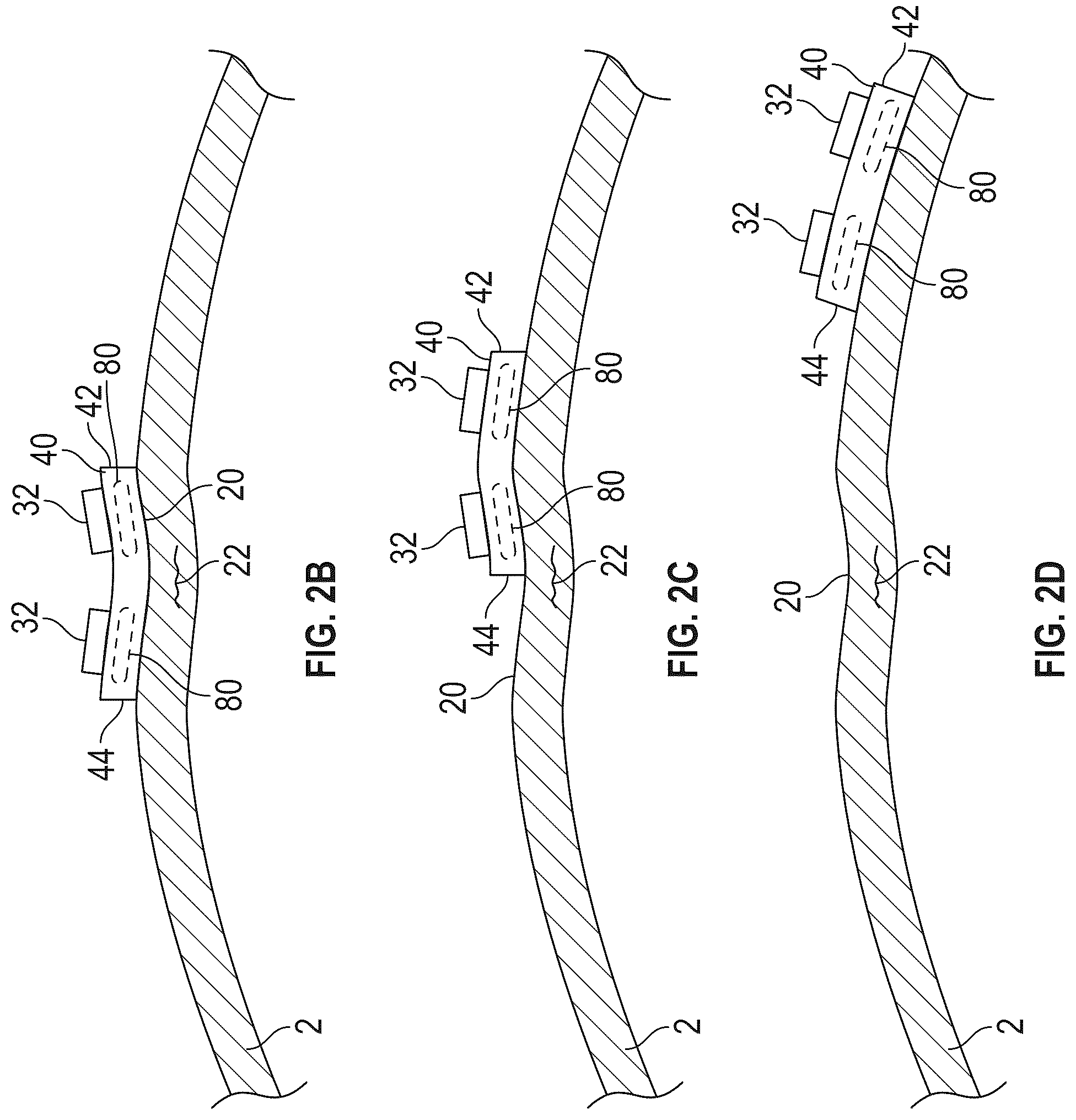 Patent US12092610 Figure 2 – Apparatus, systems, and methods for inspecting tubulars employing flexible inspection shoes
