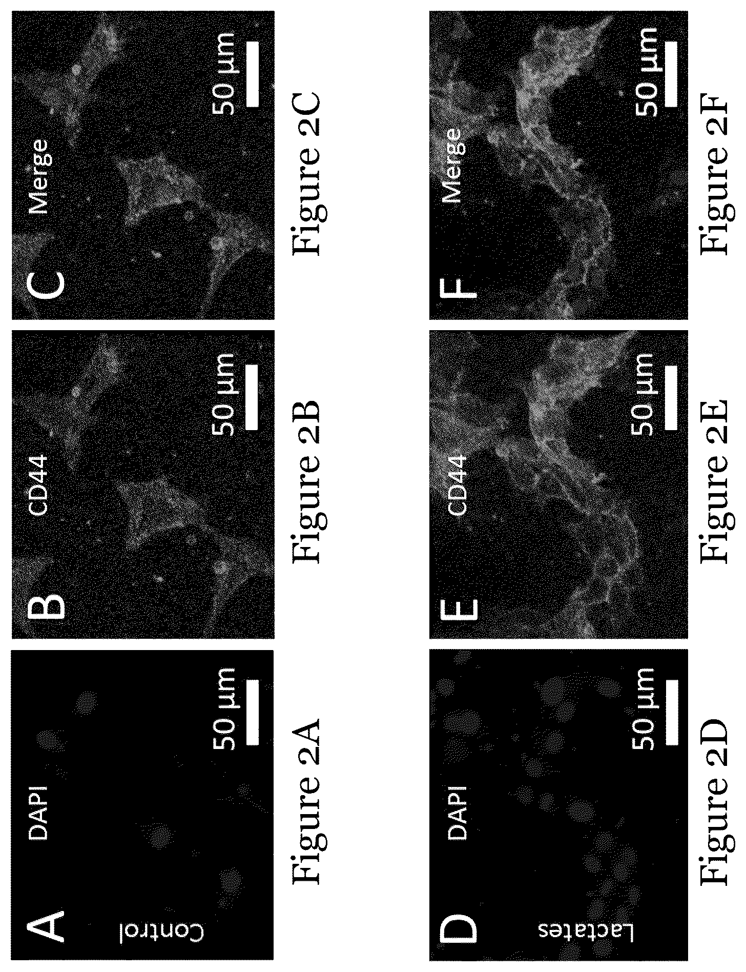 Patent US12092636 Figure 2 – Sensor for liquid biopsy and its method of making, and method of non-invasive liquid biopsy